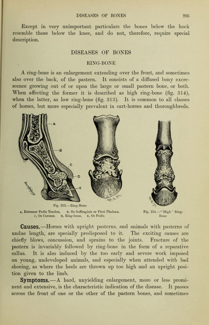 Except in very unimportant particulars the bones below the hock resemble those below the knee, and do not, therefore, require special description. DISEASES OF BONES RING-BONE A ring-bone is an enlargement extending over the front, and sometimes also over the back, of the pastern. It consists of a diffused bony excre- scence growing out of or upon the large or small pastern bone, or both. When affecting the former it is described as high ring-bone (fig. 314), when the latter, as low ring-bone (fig. 313). It is common to all classes of horses, but more especially prevalent in cart-horses and thoroughbreds. a, Extensor Pedis Tendon. B, Os Suffraginis or First Phalanx. C, Os Coronas. D, Ring-bone. E, Os Pedis. Fig. 314.—“High” Ring- Bone Causes.—Horses with upright pasterns, and animals with pasterns of undue length, are specially predisposed to it. The exciting causes are chiefly blows, concussion, and sprains to the joints. Fracture of the pastern is invariably followed by ring-bone in the form of a reparative callus. It is also induced by the too early and severe work imposed on young, undeveloped animals, and especially when attended with bad shoeing, as where the heels are thrown up too high and an upright posi- tion given to the limb. Symptoms.—A hard, unyielding enlargement, more or less promi- nent and extensive, is the characteristic indication of the disease. It passes across the front of one or the other of the pastern bones, and sometimes