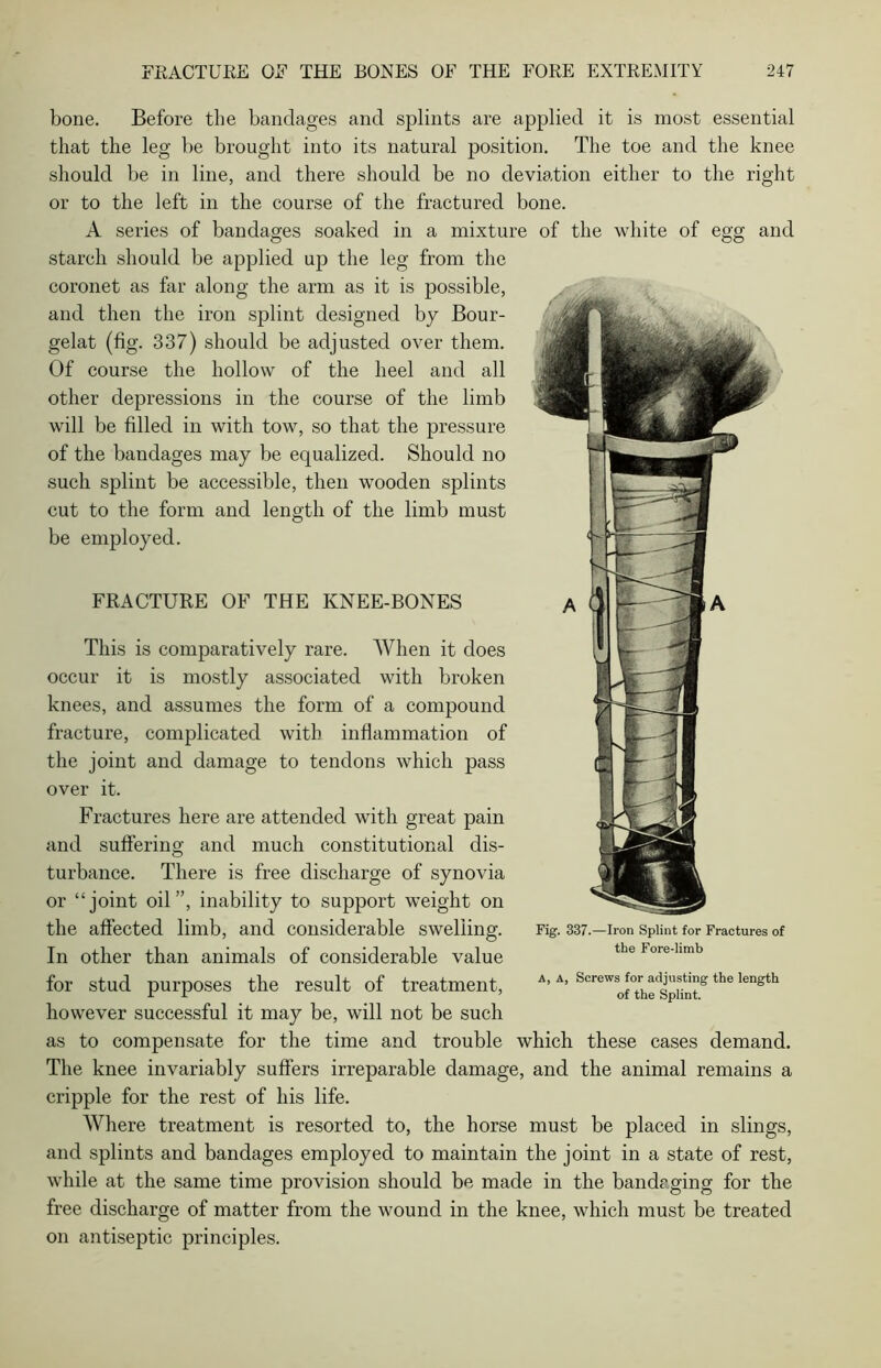 bone. Before the bandages and splints are applied it is most essential that the leg be brought into its natural position. The toe and the knee should be in line, and there should be no deviation either to the right or to the left in the course of the fractured bone. A series of bandages soaked in a mixture of the white of egg and starch should be applied up the leg from the coronet as far along the arm as it is possible, and then the iron splint designed by Bour- gelat (fig. 337) should be adjusted over them. Of course the hollow of the heel and all other depressions in the course of the limb will be filled in with tow, so that the pressure of the bandages may be equalized. Should no such splint be accessible, then wooden splints cut to the form and length of the limb must be employed. FRACTURE OF THE KNEE-BONES This is comparatively rare. When it does occur it is mostly associated with broken knees, and assumes the form of a compound fracture, complicated with inflammation of the joint and damage to tendons which pass over it. Fractures here are attended with great pain and suffering and much constitutional dis- turbance. There is free discharge of synovia or “joint oil”, inability to support weight on the affected limb, and considerable swelling. In other than animals of considerable value for stud purposes the result of treatment, however successful it may be, will not be such as to compensate for the time and trouble which these cases demand. The knee invariably suffers irreparable damage, and the animal remains a cripple for the rest of his life. Where treatment is resorted to, the horse must be placed in slings, and splints and bandages employed to maintain the joint in a state of rest, while at the same time provision should be made in the bandaging for the free discharge of matter from the wound in the knee, which must be treated on antiseptic principles. Fig. 337.—Iron Splint for Fractures of the Fore-limb a, A, Screws for adjusting the length of the Splint.