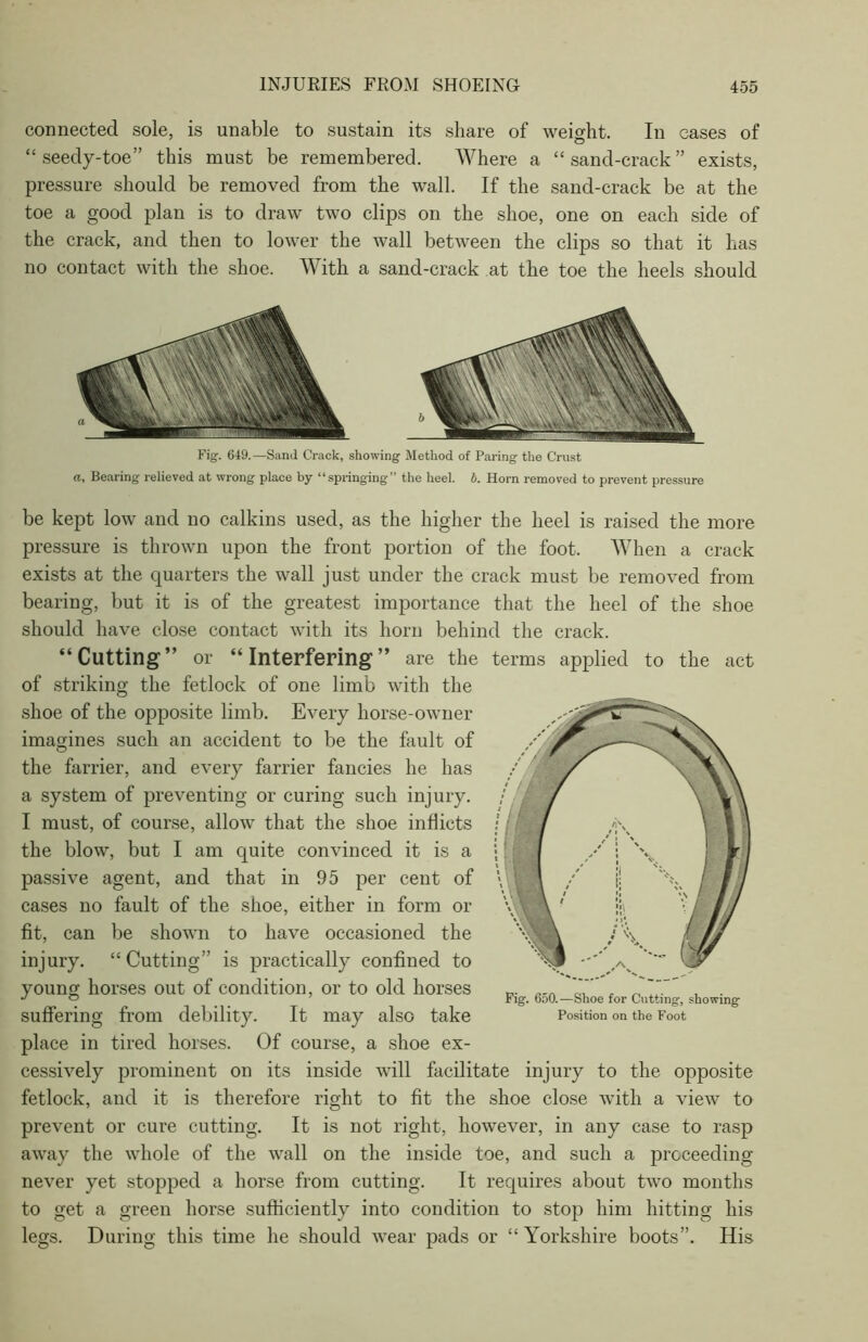 connected sole, is unable to sustain its share of weight. In cases of “ seedy-toe” this must be remembered. Where a “sand-crack” exists, pressure should be removed from the wall. If the sand-crack be at the toe a good plan is to draw two clips on the shoe, one on each side of the crack, and then to lower the wall between the clips so that it has no contact with the shoe. With a sand-crack at the toe the heels should Fig. 649.—Sand Crack, showing Method of Paring the Crust a. Bearing relieved at wrong place by “springing” the heel. b. Horn removed to prevent pressure be kept low and no calkins used, as the higher the heel is raised the more pressure is thrown upon the front portion of the foot. When a crack exists at the quarters the wall just under the crack must be removed from bearing, but it is of the greatest importance that the heel of the shoe should have close contact with its horn behind the crack. “Cutting” or “Interfering” are the of striking the fetlock of one limb with the shoe of the opposite limb. Every horse-owner imagines such an accident to be the fault of the farrier, and every farrier fancies he has a system of preventing or curing such injury. I must, of course, allow that the shoe indicts the blow, but I am quite convinced it is a passive agent, and that in 95 per cent of cases no fault of the shoe, either in form or fit, can be shown to have occasioned the injury. “ Cutting” is practically confined to young horses out of condition, or to old horses suffering from debility. It may also take place in tired horses. Of course, a shoe ex- cessively prominent on its inside will facilitate injury to the opposite fetlock, and it is therefore right to fit the shoe close with a view to prevent or cure cutting. It is not right, however, in any case to rasp away the whole of the wall on the inside toe, and such a proceeding never yet stopped a horse from cutting. It requires about two months to get a green horse sufficiently into condition to stop him hitting his legs. During this time he should wear pads or “ Yorkshire boots”. His terms applied to the act Fig. 650.—Shoe for Cutting, showing Position on the Foot