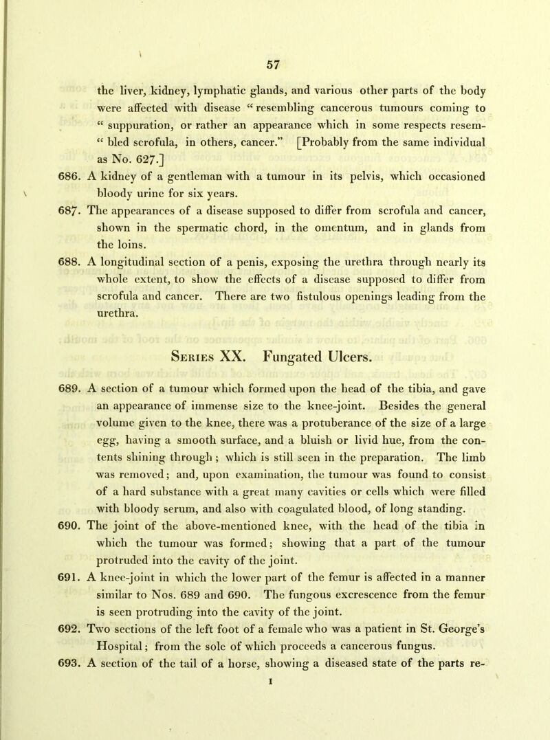 \ the liver, kidney, lymphatic glands, and various other parts of the body were affected with disease “ resembling cancerous tumours coming to “ suppuration, or rather an appearance which in some respects resem- “ bled scrofula, in others, cancer.” [Probably from the same individual as No. 627.] 686. A kidney of a gentleman with a tumour in its pelvis, which occasioned bloody urine for six years. 687. The appearances of a disease supposed to differ from scrofula and cancer, shown in the spermatic chord, in the omentum, and in glands from the loins. 688. A longitudinal section of a penis, exposing the urethra through nearly its whole extent, to show the effects of a disease supposed to differ from scrofula and cancer. There are two fistulous openings leading from the urethra. Series XX. Fungated Ulcers. 689. A section of a tumour which formed upon the head of the tibia, and gave an appearance of immense size to the knee-joint. Besides the general volume given to the knee, there was a protuberance of the size of a large egg, having a smooth surface, and a bluish or livid hue, from the con- tents shining through ; which is still seen in the preparation. The limb was removed; and, upon examination, the tumour was found to consist of a hard substance with a great many cavities or cells which were filled with bloody serum, and also with coagulated blood, of long standing. 690. The joint of the above-mentioned knee, with the head of the tibia in which the tumour was formed; showing that a part of the tumour protruded into the cavity of the joint. 691. A knee-joint in which the lower part of the femur is affected in a manner similar to Nos. 689 and 690. The fungous excrescence from the femur is seen protruding into the cavity of the joint. 692. Two sections of the left foot of a female who was a patient in St. George’s Hospital; from the sole of which proceeds a cancerous fungus. 693. A section of the tail of a horse, showing a diseased state of the parts re- 1