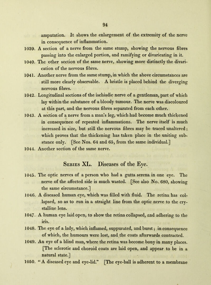 amputation. It shows the enlargement of the extremity of the nerve in consequence of inflammation. 1039. A section of a nerve from the same stump, showing the nervous fibres passing into the enlarged portion, and ramifying or divaricating in it. 1040. The other section of the same nerve, showing more distinctly the divari- cation of the nervous fibres. 1041. Another nerve from the same stump, in which the above circumstances are still more clearly observable. A bristle is placed behind the diverging nervous fibres. 1042. Longitudinal sections of the ischiadic nerve of a gentleman, part of which lay within the substance of a bloody tumour. The nerve was discoloured at this part, and the nervous fibres separated from each other. 1043. A section of a nerve from a man’s leg, which had become much thickened in consequence of repeated inflammations. The nerve itself is much increased in size, but still the nervous fibres may be traced unaltered; which proves that the thickening has taken place in the uniting sub- stance only. [See Nos. 64 and 65, from the same individual.] 1044. Another section of the same nerve. Series XL. Diseases of the Eve. 1045. The optic nerves of a person who had a gutta serena in one eye. The nerve of the affected side is much wasted. [See also No. 680, showing the same circumstance.] 1046. A diseased human eye, which was filled with fluid. The retina has col- lapsed, so as to run in a straight line from the optic nerve to the cry- stalline lens. 1047. A human eye laid open, to show the retina collapsed, and adhering to the iris. 1048. The eye of a lady, which inflamed, suppurated, and burst; in consequence of which, the humours were lost, and the coats afterwards contracted. 1049. An eye of a blind man, where the retina was become bony in many places. [The sclerotic and choroid coats are laid open, and appear to be in a natural state.] 1050. “A diseased eye and eye-lid.” [The eye-ball is adherent to a membrane