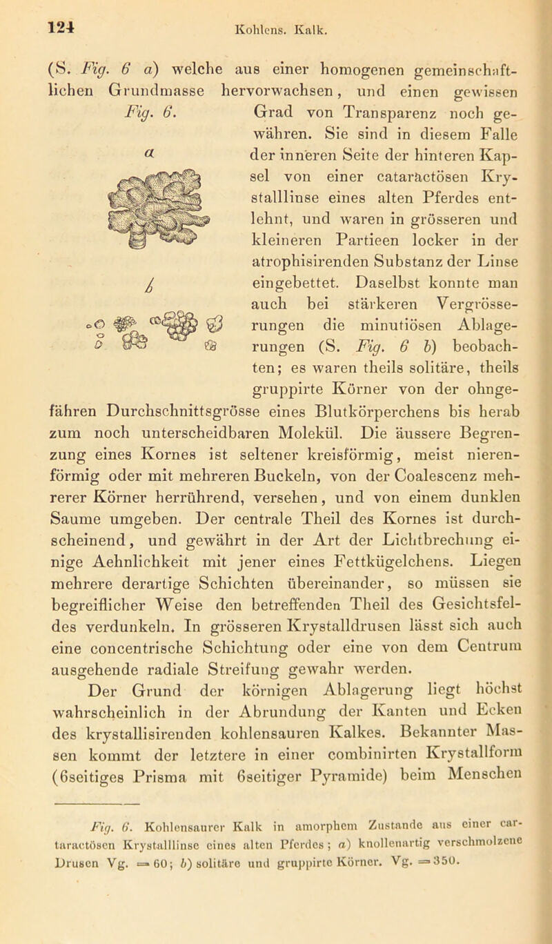 « £ o 0 cßd $ (S. Fig. 6 a) welche aus einer homogenen gemeinschaft- lichen Grundmasse hervorwachsen, und einen gewissen Fig. 6. Grad von Transparenz noch ge- währen. Sie sind in diesem Falle der inneren Seite der hinteren Kap- sel von einer cataräctösen Kry- stalllinse eines alten Pferdes ent- lehnt, und wraren in grösseren und kleineren Partieen locker in der atrophisirenden Substanz der Linse eingebettet. Daselbst konnte man auch bei stärkeren Vergrösse- rungen die minutiösen Ablage- rungen (S. Fig. 6 b) beobach- ten; es waren theils solitäre, theils gruppirte Körner von der ohnge- fähren Durchschnittsgrösse eines Blutkörperchens bis herab zum noch unterscheidbaren Molekül. Die äussere Begren- zung eines Kornes ist seltener kreisförmig, meist nieren- förmig oder mit mehreren Buckeln, von der Coalescenz meh- rerer Körner herrührend, versehen, und von einem dunklen Saume umgeben. Der centrale Theil des Kornes ist durch- scheinend, und gewährt in der Art der Lichtbrechung ei- nige Aehnlichkeit mit jener eines Fettkügelchens. Liegen mehrere derartige Schichten übereinander, so müssen sie begreiflicher Weise den betreffenden Theil des Gesichtsfel- des verdunkeln. In grösseren Krystalldrusen lässt sich auch eine concentrische Schichtung oder eine von dem Centrum ausgehende radiale Streifung gewahr werden. Der Grund der körnigen Ablagerung liegt höchst wahrscheinlich in der Abrundung der Kanten und Leken des krystallisirenden kohlensauren Kalkes. Bekannter Mas- sen kommt der letztere in einer combinirten Krystallform (ßseitiges Prisma mit Gseitiger Pyramide) beim Menschen Fig. 6. Kohlensaurer Kalk in amorphem Zustande aus einer car- taraetösen Krystalllinse eines alten Pferdes; a) knollenartig verschmolzene Drusen Yg. =60; b) solitäre und gruppirte Körner. Yg. =350.