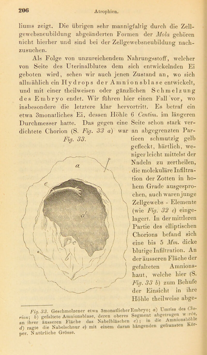 liums zeigt. Die übrigen sehr mannigfaltig durch die Zell- gewebsneubildung abgeänderten Formen der Mola gehören nicht hierher und sind hei der Zellgewebsneubildung nach- zusuchen. Als Folge von unzureichendem Nahrungsstoff, welcher von Seite des Uterinalblutes dem sich entwickelnden Ei geboten wird, sehen wir auch jenen Zustand an, wo sich allmählich ein Hydrops der Amnionsblase entwickelt, und mit einer theilweisen oder gänzlichen Schmelzung des Embryo endet. Wir führen hier einen Fall vor, wo insbesondere die letztere klar hervortritt. Es betraf ein etwa ömonatliches Ei, dessen Höhle 6 Centim. im längeren Durchmesser hatte. Das gegen eine Seite schon stark ver- dichtete Chorion (S. Fig. 33 a) war an abgegrenzten Par- Fig. 33. tieen schmutzig gelb gefleckt, härtlich, we- niger leicht mittelst der Nadeln zu zertheilen, die molekuläre Infiltra- tion der Zotten in ho- hem Grade ausgespro- chen, auch waren junge Zellgewebs - Elemente (w'ie Fig. 32 c) einge- lagert. In der mittleren Partie des elliptischen Chorions befand sich eine bis 5 Mm. dicke blutigeInfiltration. An der äusseren Fläche der gefalteten Amnions- haut, welche hier (S. Fig. 33 b) zum Behufe der Einsicht in ihre Höhle theilweise abge- Fiq.33. Geschmolzener etwa 3monntlicherEmbryo; a) Umriss des C o- rion: b) gefaltete Amnionsblase, deren oberes Segment abgetragen wr‘,e’ an ihrer äusseren Fläche das Nabelbläschen c) ; in die Amnions io i d) ragte die Nabelschnur e) mit einem daran hängenden gefransten o - per. N atürliche Grösse.