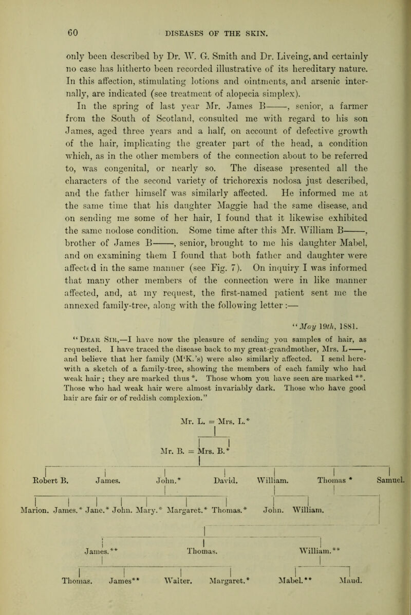 only been described by Dr. W. G. Smith and Dr. Liveing, and certainly no case has hitherto been recorded illustrative of its hereditary nature. In this affection, stimulating lotions and ointments, and arsenic inter- nally, are indicated (see treatment of alopecia simplex). In the spring of last year Mr. James B , senior, a farmer from the South of Scotland, consulted me with regard to his son James, aged three years and a half, on account of defective growth of the hair, implicating the greater part of the head, a condition which, as in the other members of the connection about to be referred to, was congenital, or nearly so. The disease presented all the characters of the second variety of trichorexis nodosa just described, and the father himself was similarly affected. He informed me at the same time that his daughter Maggie had the same disease, and on sending me some of her hair, I found that it likewise exhibited the same nodose condition. Some time after this Mr. William B , brother of James B , senior, brought to me his daughter Mabel, and on examining them I found that both father and daughter were affected in the same manner (see Fig. 7). On inquiry I was informed that many other members of the connection were in like manner affected, and, at my request, the first-named patient sent me the annexed family-tree, along with the following letter :— “ Jfoy 19th, 1S81. “Dear Sir,—I have now the pleasure of sending you samples of hair, as requested. I have traced the disease back to my great-grandmother, Mrs. L , and believe that her family (M‘K.’s) were also similarly affected. I send here- with a sketch of a family-tree, showing the members of each family who had weak hair ; they are marked thus *. Those whom you have seen are marked **. Those who had weak hair were almost invariably dark. Those who have good hair are fair or of reddish complexion.” Mr. L. = Mrs. L.* Mr. B. = Mrs. B.* Robert B. James. John.* David. William. Thomas* Samuel. Marion. James.* Jane.* John. Mary.* Margaret.* Thomas.* John. William. James.** Thomas. William.** Thomas. James** Waiter. Margaret.* Mabel.** Maud.