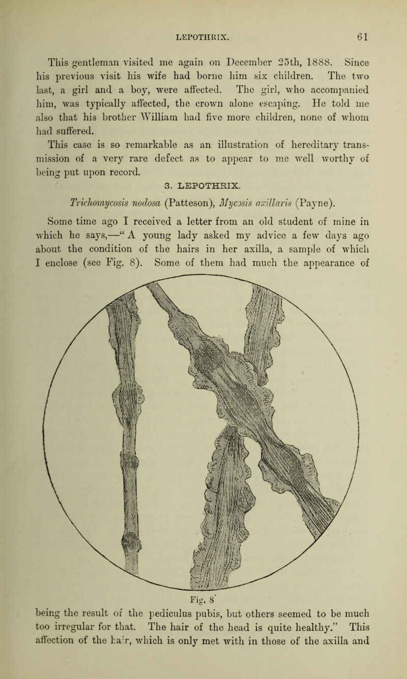 This gentleman visited me again on December 25th, 1888. Since his previous visit his wife had borne him six children. The two last, a girl and a boy, were affected. The girl, who accompanied him, was typically affected, the crown alone escaping. He told me also that his brother William had five more children, none of whom had suffered. This case is so remarkable as an illustration of hereditary trans- mission of a very rare defect as to appear to me well worthy of being put upon record. 3. LEPOTHBIX. Trichomycosis nodosa (Patteson), Mycosis axillaris (Payne). Some time ago I received a letter from an old student of mine in which he says,—“ A young lady asked my advice a few days ago about the condition of the hairs in her axilla, a sample of which I enclose (see Fig. 8). Some of them had much the appearance of being the result of the pediculus pubis, but others seemed to be much too irregular for that. The hair of the head is quite healthy.” This affection of the hair, which is only met with in those of the axilla and