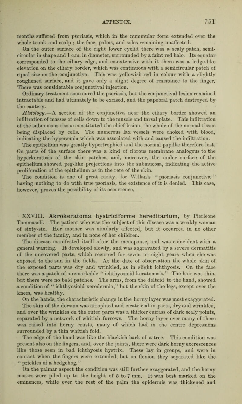 months suffered from psoriasis, which in the nummular form extended over the whole trunk and scalp ; the face, palms, and soles remaining unaffected. On the outer surface of the right lower eyelid there was a scaly patch, semi- circular in shape and 1 c.m. in diameter, surrounded by a faint red halo. Its equator corresponded to the ciliary edge, and co-extensive with it there was a ledge-like elevation on the ciliary border, which was continuous with a semicircular patch of equal size on the conjunctiva. This was yellowish-red in colour with a slightly roughened surface, and it gave only a slight degree of resistance to the finger. There was considerable conjunctival injection. Ordinary treatment soon cured the psoriasis, but the conjunctival lesion remained intractable and had ultimately to be excised, and the papebral patch destroyed by the cautery. Histology.—A section of the conjunctiva near the ciliary border showed an infiltration of masses of cells down to the muscle and tarsal plate. This infiltration of the submucous tissue constituted the chief lesion, the whole of the normal tissue being displaced by cells. The numerous lax vessels were choked with blood, indicating the hypersemia which was associated with and caused the infiltration. The epithelium was greatly hypertrophied and the normal papillae therefore lost. On parts of the surface there was a kind of fibrous membrane analogous to the hyperkeratosis of the skin patches, and, moreover, the under surface of the epithelium showed peg-like projections into the submucosa, indicating the active proliferation of the epithelium as in the rete of the skin. The condition is one of great rarity, for Willan’s “ psoriasis conjunctive ” having nothing to do with true psoriasis, the existence of it is denied. This case, however, proves the possibility of its occurrence. XXVIII. Akrokeratoma hystrieiforme hereditarium, by Pierleone Tommasoli.—The patient who was the subject of this disease was a weakly woman of sixty-six. Her mother was similarly affected, but it occurred in no other member of the family, and in none of her children. The disease manifested itself after the menopause, and was coincident with a general wasting. It developed slowly, and was aggravated by a severe dermatitis of the uncovered parts, which recurred for seven or eight years when she was exposed to the sun in the fields. At the date of observation the whole skin of the exposed parts was dry and wrinkled, as in slight ichthyosis. On the face there was a patch of a remarkable “ ichthyosioid keratonosis. ” The hair was thin, but there were no bald patches. The arms, from the deltoid to the hand, showed a condition of “ ichthyosioid xerodermia,” but the skin of the legs, except over the knees, was healthy. On the hands, the characteristic change in the horny layer was most exaggerated. The skin of the dorsum was atrophied and cicatricial in parts, dry and wrinkled, and over the wrinkles on the outer parts was a thicker cuirass of dark scaly points, separated by a network of whitish furrows. The horny layer over many of these was raised into horny crusts, many of which had in the centre depressions surrounded by a thin whitish fold. The edge of the hand was like the blackish bark of a tree. This condition was present also on the fingers, and, over the joints, there were dark horny excrescences like those seen in bad ichthyosis hystrix. These lay in groups, and were in contact when the fingers were extended, but on flexion they separated like the “ prickles of a hedgehog.” On the palmar aspect the condition w’as still further exaggerated, and the horny masses were piled up to the height of 5 to 7 mm. It was best marked on the eminences, while over the rest of the palm the epidermis was thickened and