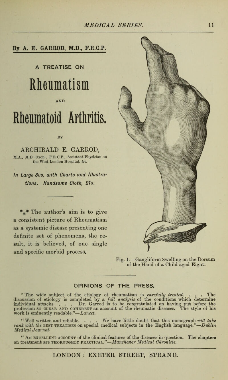 By A. E. GARROD, M.D., F.R.C.P. A TREATISE ON Rheumatism AMD Rheumatoid Arthritis. BY ARCHIBALD E. GARROD, M.A., M.D. Oxon., F.R.C.P., Assistant-Physician to the West London Hospital, &c. In Large 8uo, with Charts and Illustra- tions. Handsome Cloth, 21s. *#* The author’s aim is to give a consistent picture of Rheumatism as a systemic disease presenting one definite set of phenomena, the re- sult, it is believed, of one single and specific morbid process. OPINIONS OF THE PRESS. “ The wide subject of the etiology of rheumatism is carefully treated. . . . The discussion of etiology is completed by a full analysis of the conditions which determine individual attacks. . . . Dr. Garrod is to be congratulated on having put before the profession so clear and coherent an account of the rheumatic diseases. The style of his work is eminently readable.”—Lancet. “Well written and reliable. . . . We have little doubt that this monograph will take rank with the best treatises on special medical subjects in the English language.”—Dublin Medical Journal. “ An excellent account of the clinical features of the diseases in question. The chapters on treatment are thoroughly practical.”—Manchester Medical Chronicle.