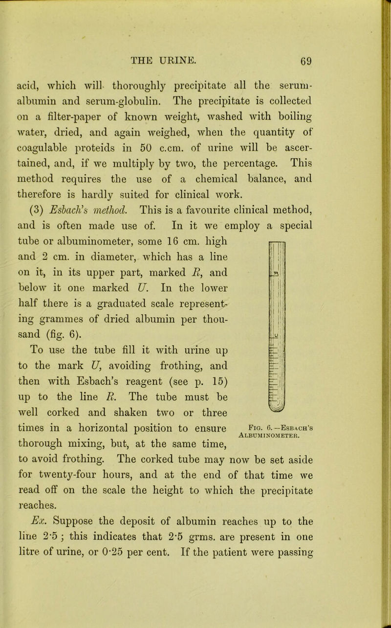 acid, which will- thoroughly precipitate all the serum- albumin and serum-globulin. The precipitate is collected on a filter-paper of known weight, washed with boiling water, dried, and again weighed, when the quantity of coagulable proteids in 50 c.cm. of urine will be ascer- tained, and, if we multiply by two, the percentage. This method requires the use of a chemical balance, and therefore is hardly suited for clinical work. (3) Esbach’s method. This is a favourite clinical method, and is often made use of. In it we employ a special tube or albuminometer, some 16 cm. high and 2 cm. in diameter, which has a line on it, in its upper part, marked R, and below it one marked U. In the lower half there is a graduated scale represent- ing grammes of dried albumin per thou- sand (fig. 6). To use the tube fill it with urine up to the mark U, avoiding frothing, and then with Esbach’s reagent (see p. 15) up to the line R. The tube must be well corked and shaken two or three times in a horizontal position to ensure fiq- 6.-Esbach’s Albuminometer. thorough mixing, but, at the same time, to avoid frothing. The corked tube may now be set aside for twenty-four hours, and at the end of that time we read off on the scale the height to which the precipitate reaches. Ex. Suppose the deposit of albumin reaches up to the line 2’5 ; this indicates that 2*5 grms. are present in one litre of urine, or 0*25 per cent. If the patient were passing