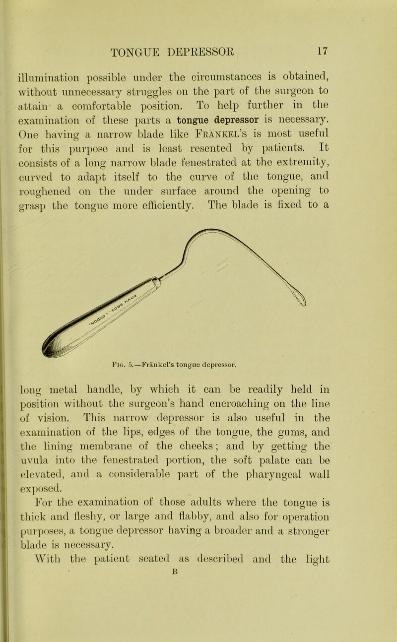 illumination possible under the circumstances is obtained, without unnecessary struggles on the part of the surgeon to attain a comfortable position. To help further in the examination of these parts a tongue depressor is necessary. One having a narrow blade like Frankel’s is most useful for this purpose and is least resented by patients. It consists of a long narrow blade fenestrated at the extremity, curved to adapt itself to the curve of the tongue, and roughened on the under surface around the opening to grasp the tongue more efficiently. The blade is fixed to a Fig. 5.—Frankel’s tongue depressor. long metal handle, by which it can be readily held in position without the surgeon’s hand encroaching on the line of vision. This narrow depressor is also useful in the examination of the lips, edges of the tongue, the gums, and the lining membrane of the cheeks; and by getting the uvula into the fenestrated portion, the soft palate can be elevated, and a considerable part of the pharyngeal wall exposed. For the examination of those adults where the tongue is o thick and lieshy, or large and flabby, and also for operation purposes, a tongue depressor having a broader and a stronger blade is necessary. With the patient seated as described and the light B