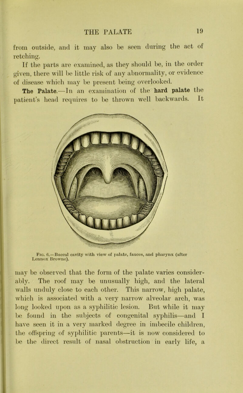from outside, and it may also be seen during the act of retching. If the parts are examined, as they should be, in the order given, there will be little risk of any abnormality, or evidence of disease which may be present being overlooked. The Palate.—In an examination of the hard palate the patient’s head requires to be thrown well backwards. It Fig. 6.—Buccal cavity with view of palate, fauces, and pharynx (after Lennox Browne). may be observed that the form of the palate varies consider- ably. The roof may be unusually high, and the lateral walls unduly close to each other. This narrow, high palate, which is associated with a very narrow alveolar arch, was long looked upon as a syphilitic lesion. But while it may be found in the subjects of congenital syphilis—and I have seen it in a very marked degree in imbecile children, the offspring of syphilitic parents—it is now considered to be the direct result of nasal obstruction in early life, a