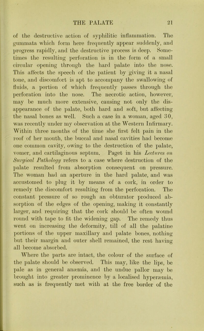 of the destructive action of sypliilitic inflammation. The gummata which form here frequently appear suddenly, and progress rapidly, and the destructive process is deep. Some- times the resulting perforation is in the form of a small circular opening through the hard palate into the nose. This affects the speech of the patient by giving it a nasal tone, and discomfort is apt to accompany the swallowing of fluids, a portion of which frequently passes through the perforation into the nose. The necrotic action, however, may be much more extensive, causing not only the dis- appearance of the palate, both hard and soft, but affecting the nasal bones as well. Such a case in a woman, aged 30, was recently under my observation at the Western Infirmary. Within three months of the time she first felt pain in the roof of her mouth, the buccal and nasal cavities had become one common cavity, owing to the destruction of the palate, vomer, and cartilaginous septum. Paget in his Lectures on Surgical Pathology refers to a case where destruction of the palate resulted from absorption consequent on pressure. The woman had an aperture in the hard palate, and was accustomed to plug it by means of a cork, in order to remedy the discomfort resulting from the perforation. The constant pressure of so rough an obturator produced ab- sorption of the edges of the opening, making it constantly larger, and requiring that the cork should be often wound round with tape to fit the widening gap. The remedy thus went on increasing the deformity, till of all the palatine portions of the upper maxillary and palate bones, nothing but their margin and outer shell remained, the rest having all become absorbed. Where the parts are intact, the colour of the surface of the palate should be observed. This may, like the lips, be pale as in general anaemia, and the undue pallor may be brought into greater prominence by a localised hyperaemia, such as is frequently met with at the free border of the