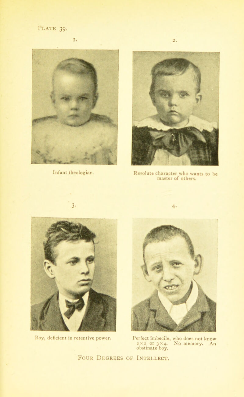 3- Boy, deficient in retentive power. Four Degrees ■ Resolute character who wants to he master of others. 4- Perfect imbecile, who does not know 3X2 or 3X4. No memory. An obstinate boy. of Intellect.