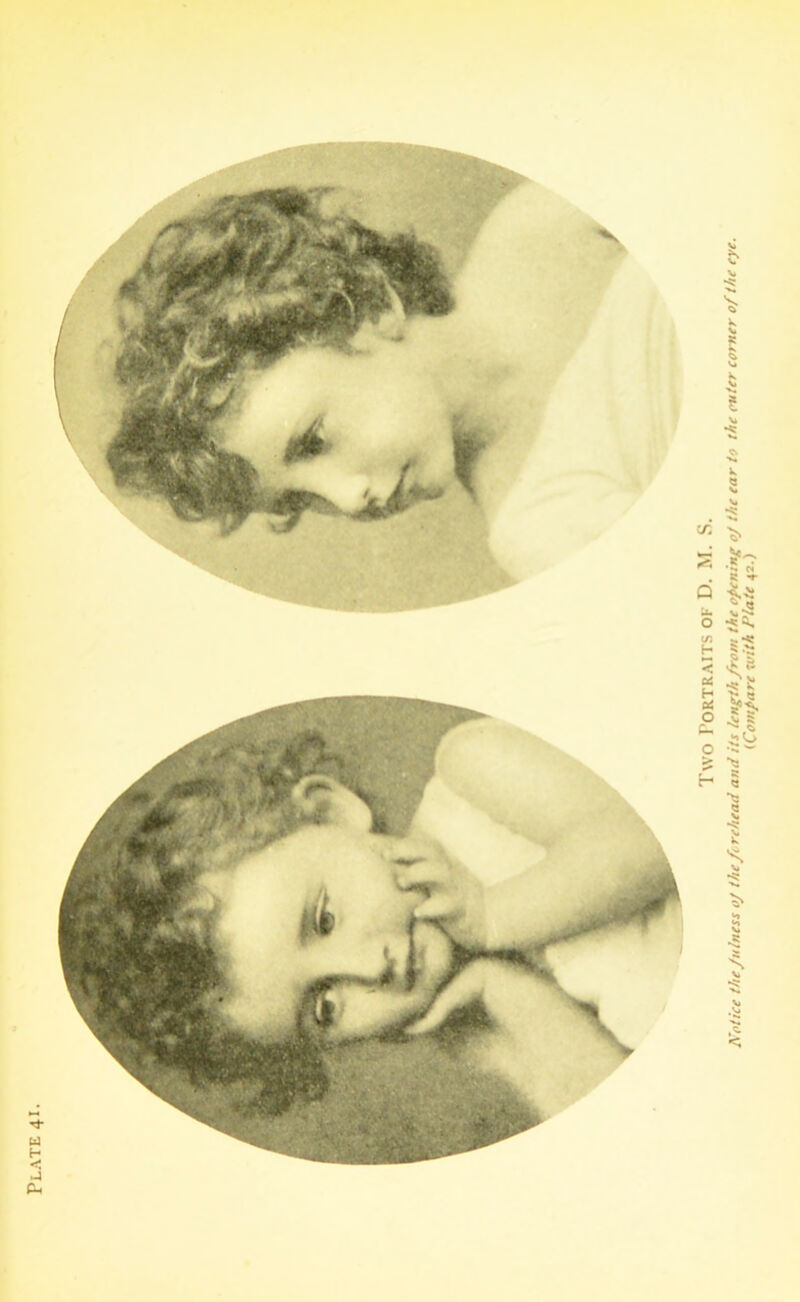 Plate 41. Two Portraits of D. M. S. Notice the Julness oj the forehead and its length from the opening oj the ear to the outer comer of the eye. (Compare with Plate 42.)