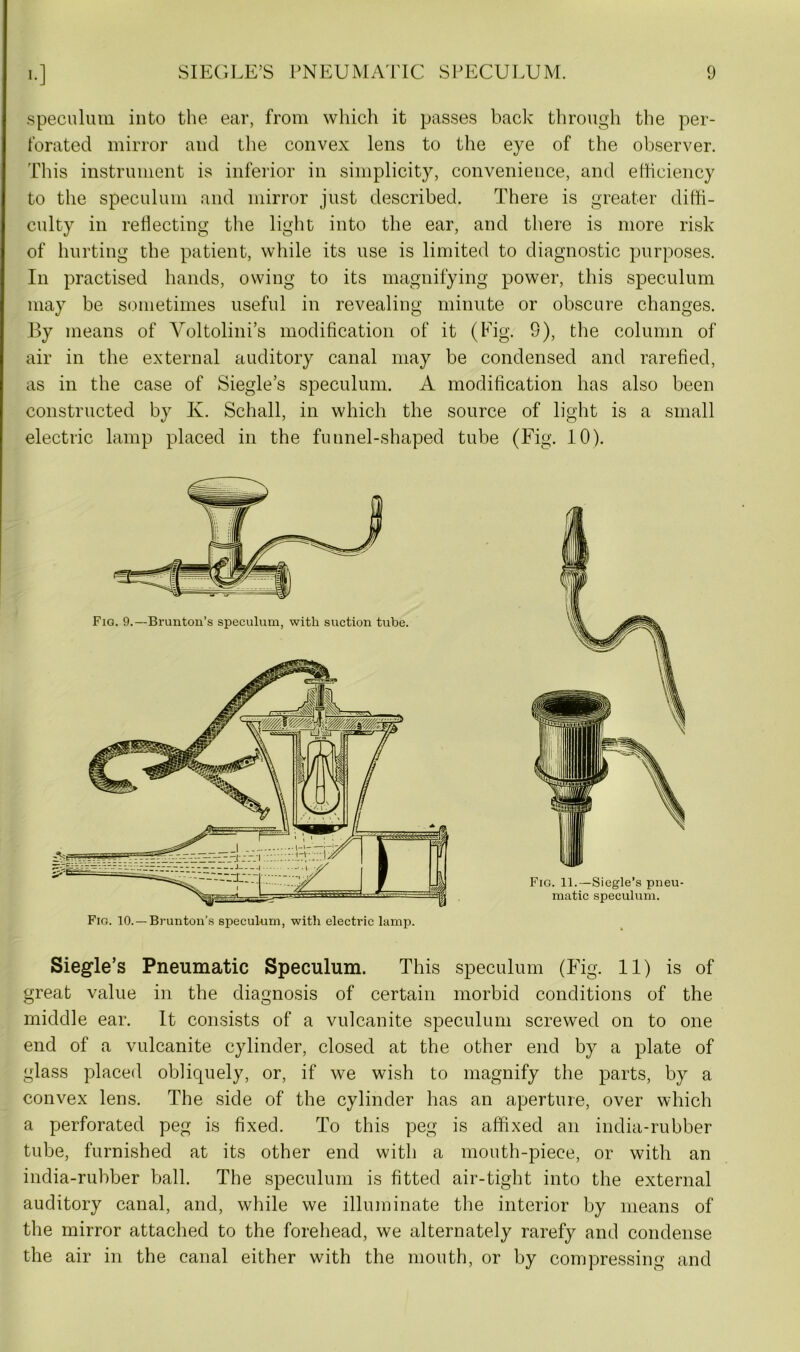 speculum into the ear, from which it passes back through the per- forated mirror and the convex lens to the eye of the observer. This instrument is inferior in simplicity, convenience, and efficiency to the speculum and mirror just described. There is greater diffi- culty in reflecting the light into the ear, and there is more risk of hurting the patient, while its use is limited to diagnostic purposes. In practised hands, owing to its magnifying power, this speculum may be sometimes useful in revealing minute or obscure changes. By means of Voltolini’s modification of it (Fig. S), the column of air in the external auditory canal may be condensed and rarefied, as in the case of Siegle’s speculum. A modification has also been constructed by K. Schall, in which the source of light is a small electric lamp placed in the funnel-shaped tube (Fig. 10). Fio. 10.—Brunton’s speculum, with electric lamp. Siegle’s Pneumatic Speculum. This speculum (Fig. 11) is of great value in the diagnosis of certain morbid conditions of the middle ear. It consists of a vulcanite speculum screwed on to one end of a vulcanite cylinder, closed at the other end by a plate of glass placed obliquely, or, if we wish to magnify the parts, by a convex lens. The side of the cylinder has an aperture, over which a perforated peg is fixed. To this peg is affixed an india-rubber tube, furnished at its other end with a mouth-piece, or with an india-rubber ball. The speculum is fitted air-tight into the external auditory canal, and, while we illuminate the interior by means of the mirror attached to the forehead, we alternately rarefy and condense the air in the canal either with the mouth, or by compressing and