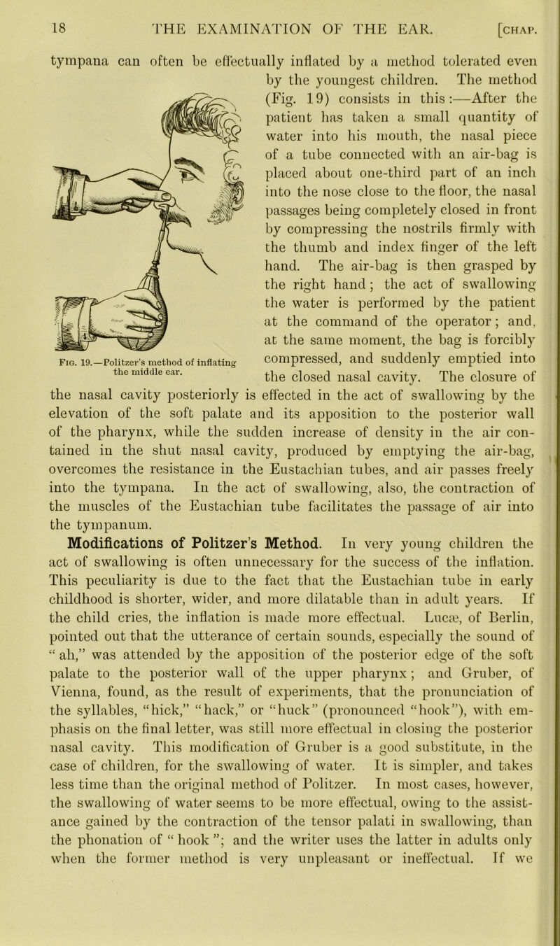 tympana can often be effectually inflated by a method tolerated even by the youngest children. The method (Fig. 19) consists in this:—After the patient has taken a small quantity of water into his mouth, the nasal piece of a tube connected with an air-bag is placed about one-third part of an inch into the nose close to the floor, the nasal passages being completely closed in front by compressing the nostrils firmly with the thumb and index finger of the left hand. The air-bag is then grasped by the right hand ; the act of swallowing the water is performed by the patient at the command of the operator; and, at the same moment, the bag is forcibly compressed, and suddenly emptied into the closed nasal cavity. The closure of the nasal cavity posteriorly is effected in the act of swallowing by the elevation of the soft palate and its apposition to the posterior wall of the pharynx, while the sudden increase of density in the air con- tained in the shut nasal cavity, produced by emptying the air-bag, overcomes the resistance in the Eustachian tubes, and air passes freely into the tympana. In the act of swallowing, also, the contraction of the muscles of the Eustachian tube facilitates the passage of air into the tympanum. Modifications of Politzer’s Method. In very young children the act of swallowing is often unnecessary for the success of the inflation. This peculiarity is due to the fact that the Eustachian tube in early childhood is shorter, wider, and more dilatable than in adult years. If the child cries, the inflation is made more effectual. Luca?, of Berlin, pointed out that the utterance of certain sounds, especially the sound of “ ah,” was attended by the apposition of the posterior edge of the soft palate to the posterior wall of the upper pharynx ; and Gruber, of Vienna, found, as the result of experiments, that the pronunciation of the syllables, “hick,” “hack,” or “buck” (pronounced “hook”), with em- phasis on the final letter, was still more effectual in closing the posterior nasal cavity. This modification of Gruber is a good substitute, in the case of children, for the swallowing of water. It is simpler, and takes less time than the original method of Politzer. In most cases, however, the swallowing of water seems to be more effectual, owing to the assist- ance gained by the contraction of the tensor palati in swallowing, than the phonation of “hook”; and the writer uses the latter in adults only when the former method is very unpleasant or ineffectual. Tf we