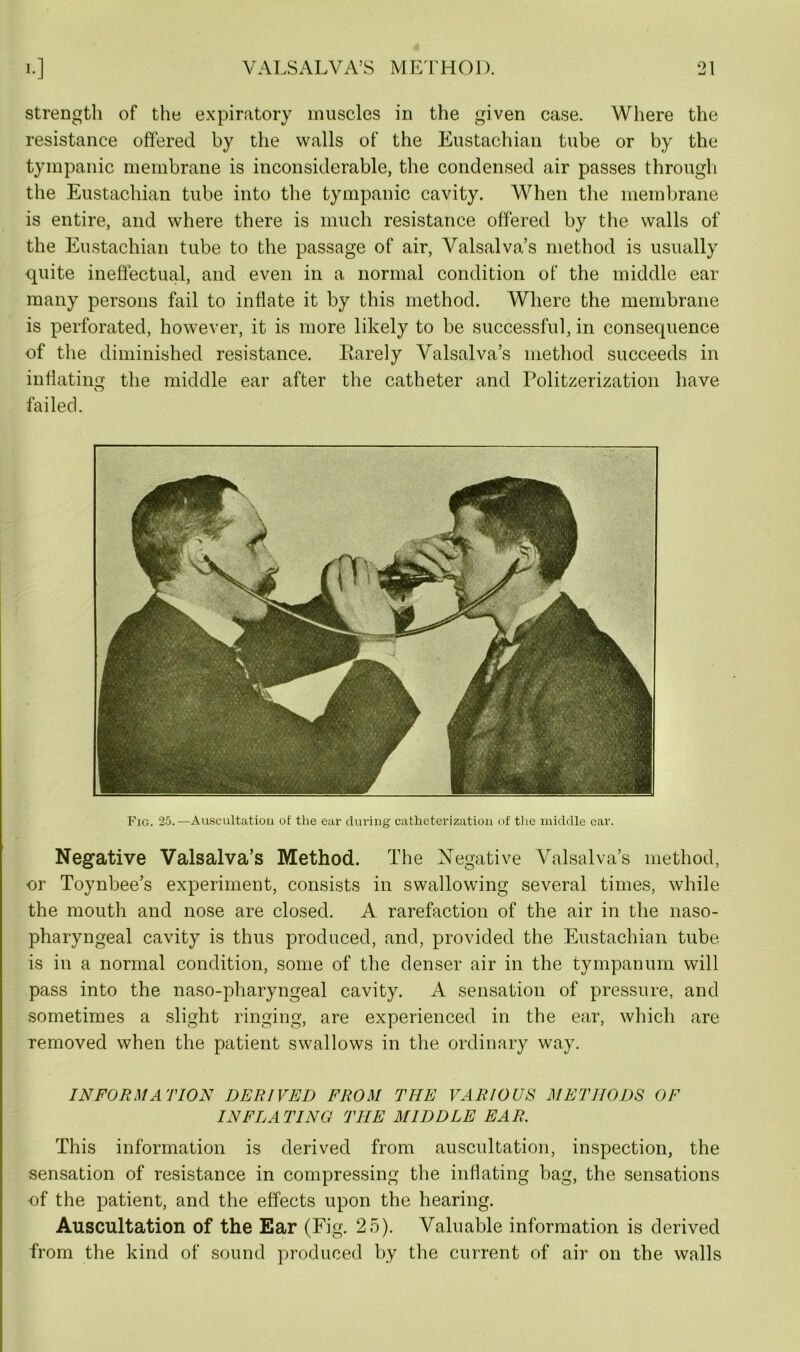 strength of the expiratory muscles in the given case. Where the resistance offered by the walls of the Eustachian tube or by the tympanic membrane is inconsiderable, the condensed air passes through the Eustachian tube into the tympanic cavity. When the membrane is entire, and where there is much resistance offered by the walls of the Eustachian tube to the passage of air, Valsalva’s method is usually quite ineffectual, and even in a normal condition of the middle ear many persons fail to inflate it by this method. Where the membrane is perforated, however, it is more likely to be successful, in consequence of the diminished resistance. Rarely Valsalva’s method succeeds in inflating the middle ear after the catheter and Politzerization have failed. Fig. 25.—Auscultation of the ear during catheterization of the middle car. Negative Valsalva’s Method. The Negative Valsalva’s method, or Toynbee’s experiment, consists in swallowing several times, while the mouth and nose are closed. A rarefaction of the air in the naso- pharyngeal cavity is thus produced, and, provided the Eustachian tube is in a normal condition, some of the denser air in the tympanum will pass into the naso-pharyngeal cavity. A sensation of pressure, and sometimes a slight ringing, are experienced in the ear, which are removed when the patient swallows in the ordinary way. INFORMATION DERIVED FROM THE VARIOUS METHODS OF INFLATING THE MIDDLE EAR. This information is derived from auscultation, inspection, the sensation of resistance in compressing the inflating bag, the sensations of the patient, and the effects upon the hearing. Auscultation of the Ear (Fig. 25). Valuable information is derived from the kind of sound produced by the current of air on the walls