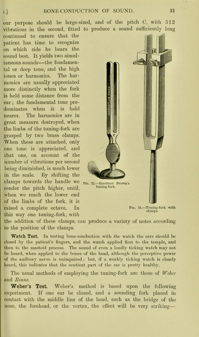I-] our purpose should be large-sized, and of the pitch C, with 512 vibrations in the second, fitted to produce a sound sufficiently long continued to ensure that the patient has time to recognize on which side he hears the sound best. It yields two simul- taneous sounds—the fundamen- tal or deep tone, and the high tones or harmonics. The har- monics are usually appreciated more distinctly when the fork is held some distance from the ear ; the fundamental tone pre- dominates when it is held nearer. The harmonics are in great measure destroyed, when the limbs of the tuning-fork are grasped by two brass clamps. When these are attached, only one tone is appreciated, and that one, on account of the number of vibrations per second being diminished, is much lower in the scale. By shifting the clamps towards the handle we render the pitch higher, until, when we reach the lower end of the limbs of the fork, it is raised a complete octave. In fig- si.—1Tuning-fork with A _ clamps. this way one tuning-fork, with the addition of these clamps, can produce a variety of notes according to the position of the clamps. Watch Test. In testing bone-conduction with the watch the ears should be closed by the patient’s fingers, and the watch applied first to the temple, and then to the mastoid process. The sound of even a loudly ticking watch may not be heard, when applied to the bones of the head, although the perceptive power of the auditory nerve is unimpaired ; but, if a weakly ticking watch is clearly heard, this indicates that the sentient part of the ear is pretty healthy. The usual methods of employing the tuning-fork are those of Weber and Rinne. Weber’s Test. Weber’s method is based upon the following experiment. If one ear be closed, and a sounding fork placed in contact with the middle line of the head, such as the bridge of the nose, the forehead, or the vertex, the effect will be very striking— Fig. 32.—Gardiner Brown’s tuning-fork.