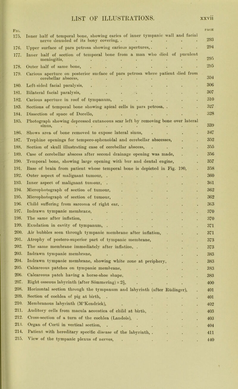 Fig. page 175. Inner half of temporal bone, showing caries of inner tympanic wall and facial nerve denuded of its bony covering, ...... 293 176. Upper surface of pars petrosa showing carious apertures,.... 294 177. Inner half of section of temporal bone from a man who died of purulent meningitis, ......... 29o 178. Outer half of same bone, . . ...... 295 179. Carious aperture on posterior surface of pars petrosa where patient died from cerebellar abscess, ........ 304 180. Left-sided facial paralysis, ........ 306 181. Bilateral facial paralysis, ........ 307 182. Carious aperture in roof of tympanum, ...... 310 183. Sections of temporal bone showing apical cells in pars petrosa, . . . 327 184. Dissection of space of Dorello, ....... 328 185. Photograph showing depressed cutaneous scar left by removing bone over lateral sinus, ........ 339 186. Shows area of bone removed to expose lateral sinus, .... 347 187. Trephine openings for temporo-sphenoidal and cerebellar abscesses, . . 352 188. Section of skull illustrating case of cerebellar abscess, .... 355 189. Case of cerebellar abscess after second drainage opening was made, . . 356 190. Temporal bone, showing large opening with bur and dental engine, . . 357 191. Base of brain from patient whose temporal bone is depicted in Fig. 190, . 358 192. Outer aspect of malignant tumour, ....... 360 193. Inner aspect of malignant tumour, ....... 361 194. Microphotograph of section of tumour, ...... 362 V 195. Microphotograph of section of tumour, ...... 362 196. Child suffering from sarcoma of right ear, ...... 363 197. Indrawn tympanic membrane, ....... 370 198. The same after inflation, ......... 370 199. Exudation in cavity of tympanum, ....... 371 200. Air bubbles seen through tympanic membrane after inflation, . . . 371 201. Atrophy of postero-superior part of tympanic membrane, . . . 373 202. The same membrane immediately after inflation, ..... 373 203. Indrawn tympanic membrane, ....... 383 204. Indrawn tympanic membrane, showing white zone at periphery, . . 383 205. Calcareous patches on tympanic membrane, ..... 3S3 206. Calcareous patch having a horse-shoe shape, ..... 383 207. Right osseous labyrinth (after Sommering) x 2i, . . . . 400 208. Horizontal section through the tympanum and labyrinth (after Riidinger), . 401 209. Section of cochlea of pig at birth, ...... 401 210. Membranous labyrinth (M‘Kendrick), ...... 402 211. Auditory cells from macula acoustica of child at birth, .... 403 212. Cross-section of a turn of the cochlea (Landois), ..... 403 213. Organ of Corti in vertical section, ....... 404 214. Patient with hereditary specific disease of the labyrinth, .... 411 215. View of the tympanic plexus of nerves, ...... 440