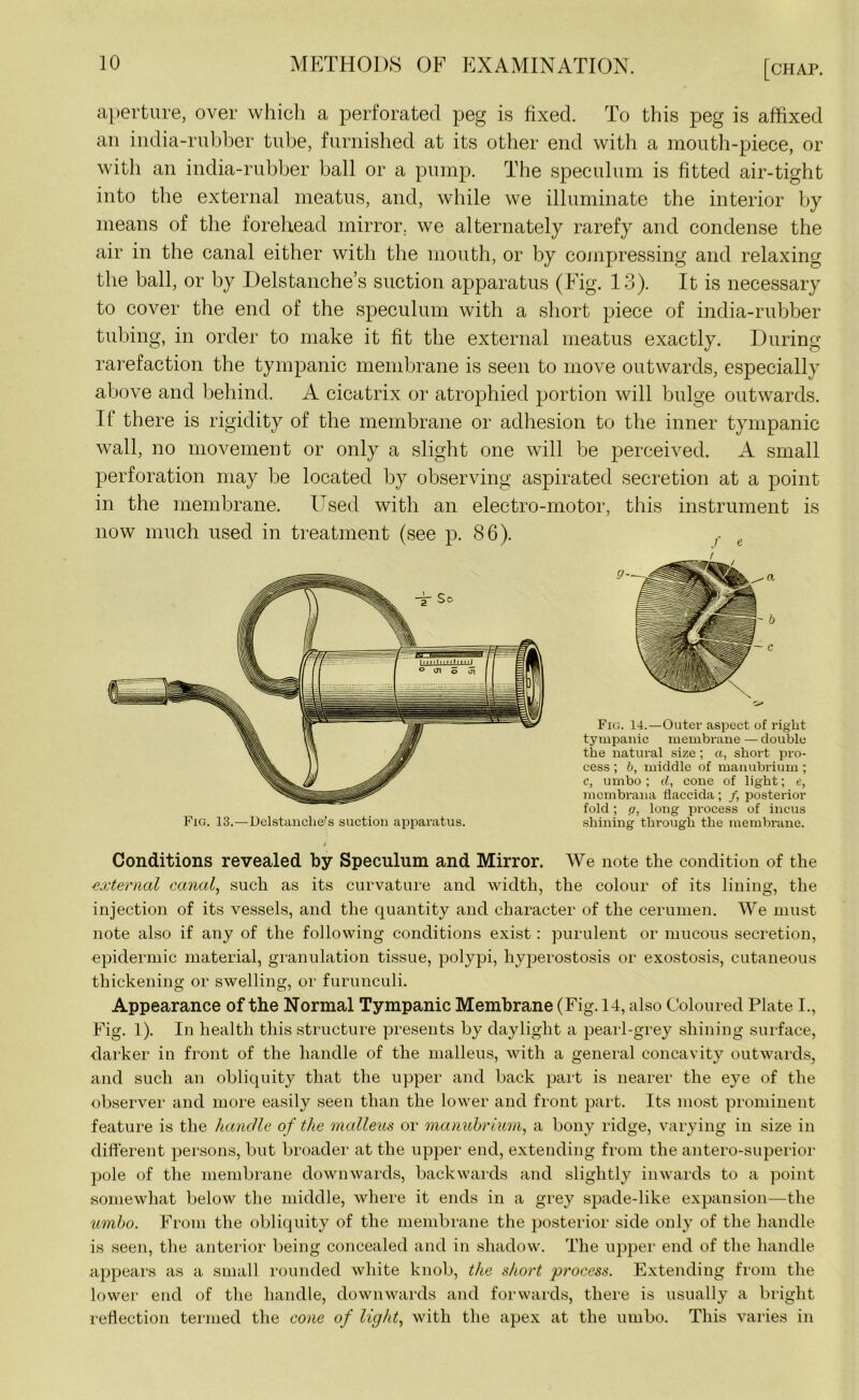aperture, over which a perforated peg is fixed. To this peg is affixed an india-rubber tube, furnished at its other end with a mouth-piece, or with an india-rubber ball or a pump. The speculum is fitted air-tight into the external meatus, and, while we illuminate the interior by means of the forehead mirror, we alternately rarefy and condense the air in the canal either with the mouth, or by compressing and relaxing the ball, or by Delstanche’s suction apparatus (Fig. 13). It is necessary to cover the end of the speculum with a short piece of india-rubber tubing, in order to make it fit the external meatus exactly. During rarefaction the tympanic membrane is seen to move outwards, especially above and behind. A cicatrix or atrophied portion will bulge outwards. If there is rigidity of the membrane or adhesion to the inner tympanic wall, no movement or only a slight one will be perceived. A small perforation may be located by observing aspirated secretion at a point in the membrane. Used with an electro-motor, this instrument is now much used in treatment (see p. 86). f e Fig. 13.—Delstanclie's suction apparatus. Fig. 14.—Outer aspect of right tympanic membrane — double the natural size ; a, short pro- cess ; b, middle of manubrium ; c, umbo; cl, cone of light; e, mcmbrana flaccida ; /, posterior fold; ci, long process of incus shining through the membrane. Conditions revealed by Speculum and Mirror. We note the condition of the external canal, such as its curvature and width, the colour of its lining, the injection of its vessels, and the quantity and character of the cerumen. We must note also if any of the following conditions exist: purulent or mucous secretion, epidermic material, granulation tissue, polypi, hyperostosis or exostosis, cutaneous thickening or swelling, or furunculi. Appearance of the Normal Tympanic Membrane (Fig. 14, also Coloured Plate I., Fig. 1). In health this structure presents by daylight a pearl-grey shining surface, darker in front of the handle of the malleus, with a general concavity outwards, and such an obliquity that the upper and back part is nearer the eye of the observer and more easily seen than the lower and front part. Its most prominent feature is the handle of the malleus or manubrium, a bony ridge, varying in size in different persons, but broader at the upper end, extending from the antero-superior pole of the membrane downwards, backwards and slightly inwards to a point somewhat below the middle, where it ends in a grey spade-like expansion—the umbo. From the obliquity of the membrane the posterior side only of the handle is seen, the anterior being concealed and in shadow. The upper end of the handle appears as a small rounded white knob, the short process. Extending from the lower end of the handle, downwards and forwards, there is usually a bright reflection termed the cone of light, with the apex at the umbo. This varies in