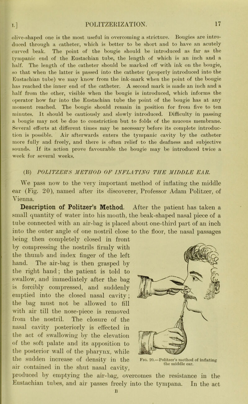 olive-shaped one is the most useful in overcoming a stricture. Bougies are intro- duced through a catheter, which is better to be short and to have an acutely curved beak. The point of the bougie should be introduced as far as the tympanic end of the Eustachian tube, the length of which is an inch and a half. The length of the catheter should be marked off with ink on the bougie, so that when the latter is passed into the catheter (properly introduced into the Eustachian tube) we may know from the ink-mark when the point of the bougie has reached the inner end of the catheter. A second mark is made an inch and a half from the other, visible when the bougie is introduced, which informs the operator how far into the Eustachian tube the point of the bougie has at any moment reached. The bougie should remain in position for from five to ten minutes. It should be cautiously and slowly introduced. Difficulty in passing a bougie may not be clue to constriction but to folds of the mucous membrane. Several efforts at different times may be necessary before its complete introduc- tion is possible. Air afterwards enters the tympanic cavity by the catheter more fully and freely, and there is often relief to the deafness and subjective sounds. If its action prove favourable the bougie may be introduced twice a week for several weeks. (B) POLITZER'S METHOD OF INFLATING THE MIDDLE EAR. We pass now to the very important method of inflating the middle ear (Fig. 20), named after its discoverer, Professor Adam Politzer, of Vienna. Description of Politzer’s Method. After the patient has taken a small quantity of water into his mouth, the beak-shaped nasal piece of a tube connected with an air-bag is placed about one-third part of an inch into the outer angle of one nostril close to the floor, the nasal passages being then completely closed in front by compressing the nostrils firmly with the thumb and index finger of the left hand. The air-bag is then grasped by the right hand; the patient is told to swallow, and immediately after the bag is forcibly compressed, and suddenly emptied into the closed nasal cavity; the bag must not be allowed to fill with air till the nose-piece is removed from the nostril. The closure of the nasal cavity posteriorly is effected in the act of swallowing by the elevation of the soft palate and its apposition to the posterior wall of the pharynx, while the sudden increase of density in the fig. 20.—Poiitzer’s method of inflating . . -. . , , . . the middle ear. air contained in the shut nasal cavity, produced by emptying the air-bag, overcomes the resistance in the Eustachian tubes, and air passes freely into the tympana. In the act B