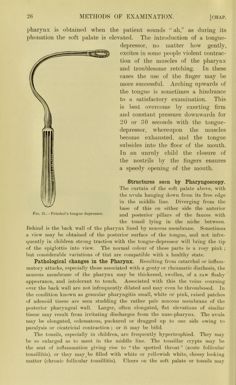 pharynx is obtained when the patient sounds “ ah,” as during its phonation the soft palate is elevated. The introduction of a tongue- depressor, no matter how gently, excites in some people violent contrac- tion of the muscles of the pharynx and troublesome retching. In these cases the use of the finger may be more successful. Arching upwards of the tongue is sometimes a hindrance to a satisfactory examination. This is best overcome by exerting firm and constant pressure downwards for 20 or 30 seconds with the tongue- depressor, whereupon the muscles become exhausted, and the tongue subsides into the floor of the mouth. In an unruly child the closure of the nostrils by the fingers ensures a speedy opening of the mouth. Structures seen by Pharyngoscopy. The curtain of the soft palate above, with, the uvula hanging down from its free edge in the middle line. Diverging from the base of this on either side the anterior and posterior pillars of the fauces with the tonsil lying in the niche between. Behind is the back wall of the pharynx lined by mucous membrane. Sometimes a view may be obtained of the posterior surface of the tongue, and not infre- quently in children strong traction with the tongue-depressor will bring the tip of the epiglottis into view. The normal colour of these parts is a rosy pink ; but considerable variations of tint are compatible with a healthy state. Pathological changes in the Pharynx. Resulting from catarrhal or inflam- matory attacks, especially those associated with a gouty or rheumatic diathesis, the mucous membrane of the pharynx may be thickened, swollen, of a raw fleshy appearance, and intolerant to touch. Associated with this the veins coursing over the back wall are not infrequently dilated and may even be thrombosed. In the condition known as granular pharyngitis small, white or pink, raised patches of adenoid tissue are seen studding the rather pale mucous membrane of the posterior pharyngeal wall. Larger, often elongated, flat elevations of similar tissue may result from irritating discharges from the naso-pharynx. The uvula may be elongated, oedematous, puckered or dragged up to one side owing to paralysis or cicatricial contraction ; or it may be bifid. The tonsils, especially in children, are frequently hypertrophied. They may be so enlarged as to meet in the middle line. The tonsillar crypts may be the seat of inflammation giving rise to “the spotted throat” (acute follicular tonsillitis), or they may be filled with white or yellowish white, cheesy looking matter (chronic follicular tonsillitis). Ulcers on the soft palate or tonsils may Fig. 31.—Frankel’s tongue depressor.