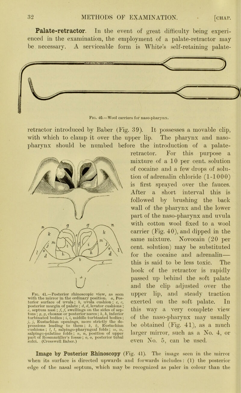 mm/m Palate-retractor. In the event of great difficulty being experi- enced in the examination, the employment of a palate-retractor may be necessary. A serviceable form is White’s self-retaining palate- Fig. 40.—Wool carriers for naso-pharynx. retractor introduced by Baber (Eig. 39). It possesses a movable clip, with which to clamp it over the upper lip. The pharynx and naso- pharynx should be numbed before the introduction of a palate- retractor. For this purpose a mixture of a 10 per cent, solution of cocaine and a few drops of solu- tion of adrenalin chloride (1-1000) is first sprayed over the fauces. After a short interval this is followed by brushing the back wall of the pharynx and the lower part of the naso-pharynx and uvula with cotton wool fixed to a wool carrier (Fig. 40), and dipped in the same mixture. Novocain (20 per cent, solution) may be substituted for the cocaine and adrenalin— this is said to be less toxic. The hook of the retractor is rapidly passed up behind the soft palate and the clip adjusted over the upper lip, and steady traction exerted on the soft palate. In this way a very complete view of the naso-pharynx may usually be obtained (Fig. 41), as a much larger mirror, such as a No. 4, or even No. 5, can be used. Image by Posterior Rhinoscopy (Fig. 41). The image seen in the mirroi when its surface is directed upwards and forwards includes: (1) the posterior edge of the nasal septum, which may be recognized as paler in colour than the Fig. 41.—Posterior rliinoscopie view, as seen with the mirror in the ordinary position, a, Pos- terior surface of uvula; b, uvula cushion; c, c, posterior margin of palate ; d, d, levator cushions ; e, septum nasi; /,/, swellings on the sides of sep- tum ; (/, [/, choanse or posterior nares; h, h, inferior turbinated bodies ; i, i, middle turbinated bodies ; j, j, Eustachian openings, more strictly the de- pressions leading to them; k, k, Eustachian cushions ; l, l, salpingo-pliaryngcal folds ; m, m, salpingo-palatine folds ; n, n, position of upper part of Rosenmuller’s fossai; o, o, posterior tubal sulci. (Cresswell Baber.)