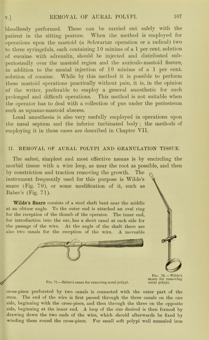 bloodlessly performed. These can be carried out safely with the patient in the sitting posture. When the method is employed for operations upon the mastoid (a Schwartze operation or a radical) two to three syringefuls, each containing 10 minims of a 1 per cent, solution of eucaine with adrenalin, should be injected and distributed sub- periosteally over the mastoid region and the auriculo-mastoid fissure, in addition to the meatal injection of 10 minims of a 1 per cent, solution of cocaine. While by this method it is possible to perform these mastoid operations practically without pain, it is, in the opinion of the writer, preferable to employ a general anaesthetic for such prolonged and difficult operations. This method is not suitable when the operator has to deal with a collection of pus under the periosteum such as squamo-mastoid abscess. Local anaesthesia is also very usefully employed in operations upon the nasal septum and the inferior turbinated body; the methods of employing it in these cases are described in Chapter VII. II. REMOVAL OF AURAL POLYPI AND GRANULATION TISSUE. The safest, simplest and most effective means is by encircling the morbid tissue with a wire loop, as near the root as possible, and then by constriction and traction removing the growth. The instrument frequently used for this purpose is Wilde’s snare (Fig. 70), or some modification of it, such as Baber’s (Fig. 71). Wilde’s Snare consists of a stee] shaft bent near the middle at an obtuse angle. To the outer end is attached an oval ring for the reception of the thumb of the operator. The inner end, for introduction into the ear, has a short canal at each side for the passage of the wire. At the angle of the shaft there are also two canals for the reception of the wire. A moveable Fig. 70.—Wilde’s snare for removing Fig. 71.—Baber’s snare for removing aural polypi. aural polypi. cross-piece perforated by two canals is connected with the outer part of the stem. The end of the wire is first passed through the three canals on the one side, beginning with the cross-piece, and then through the three on the opposite side, beginning at the inner end. A loop of the size desired is then formed by drawing down the two ends of the wire, which should afterwards be fixed by winding them round the cross-piece. For small soft polypi well annealed iron