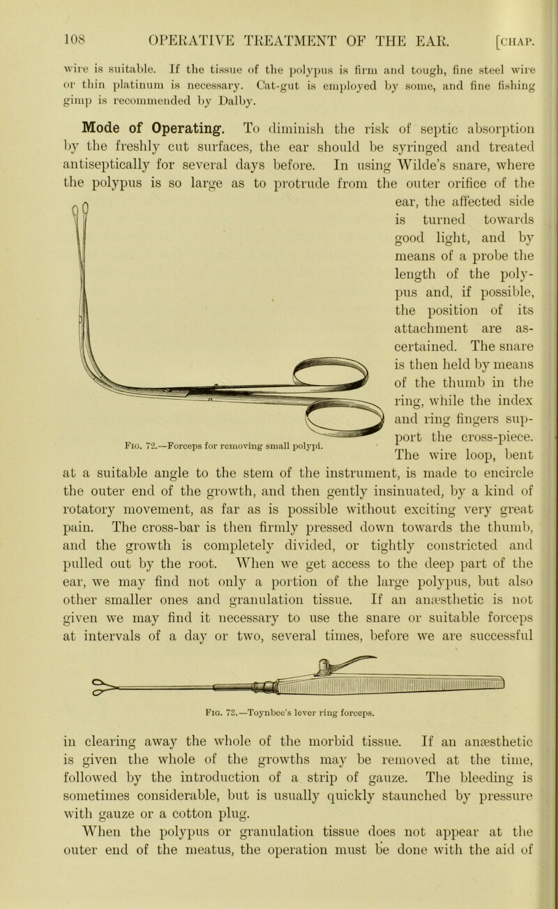 wire is suitable. If the tissue of the polypus is firm and tough, fine steel wire or thin platinum is necessary. Cat-gut is employed by some, and fine fishing gimp is recommended by Dalby. Mode of Operating. To diminish the risk of septic absorption by the freshly cut surfaces, the ear should be syringed and treated antiseptically for several days before. In using Wilde’s snare, where the polypus is so large as to protrude from the outer orifice of the ear, the affected side is turned towards good light, and by means of a probe the length of the poly- pus and, if possible, the position of its attachment are as- certained. The snare is then held by means of the thumb in the ring, while the index and ring fingers sup- port the cross-piece. Fig. 72.—Forceps for removing small polypi. A The wire loop, bent at a suitable angle to the stem of the instrument, is made to encircle the outer end of the growth, and then gently insinuated, by a kind of rotatory movement, as far as is possible without exciting very great pain. The cross-bar is then firmly pressed down towards the thumb, and the growth is completely divided, or tightly constricted and pulled out by the root. When we get access to the deep part of the ear, we may find not only a portion of the large polypus, but also other smaller ones and granulation tissue. If an anaesthetic is not given we may find it necessary to use the snare or suitable forceps at intervals of a day or two, several times, before we are successful in clearing away the whole of the morbid tissue. If an anaesthetic is given the whole of the growths may be removed at the time, followed by the introduction of a strip of gauze. The bleeding is sometimes considerable, but is usually quickly staunched by pressure with gauze or a cotton plug. When the polypus or granulation tissue does not appear at the outer end of the meatus, the operation must be done with the aid of