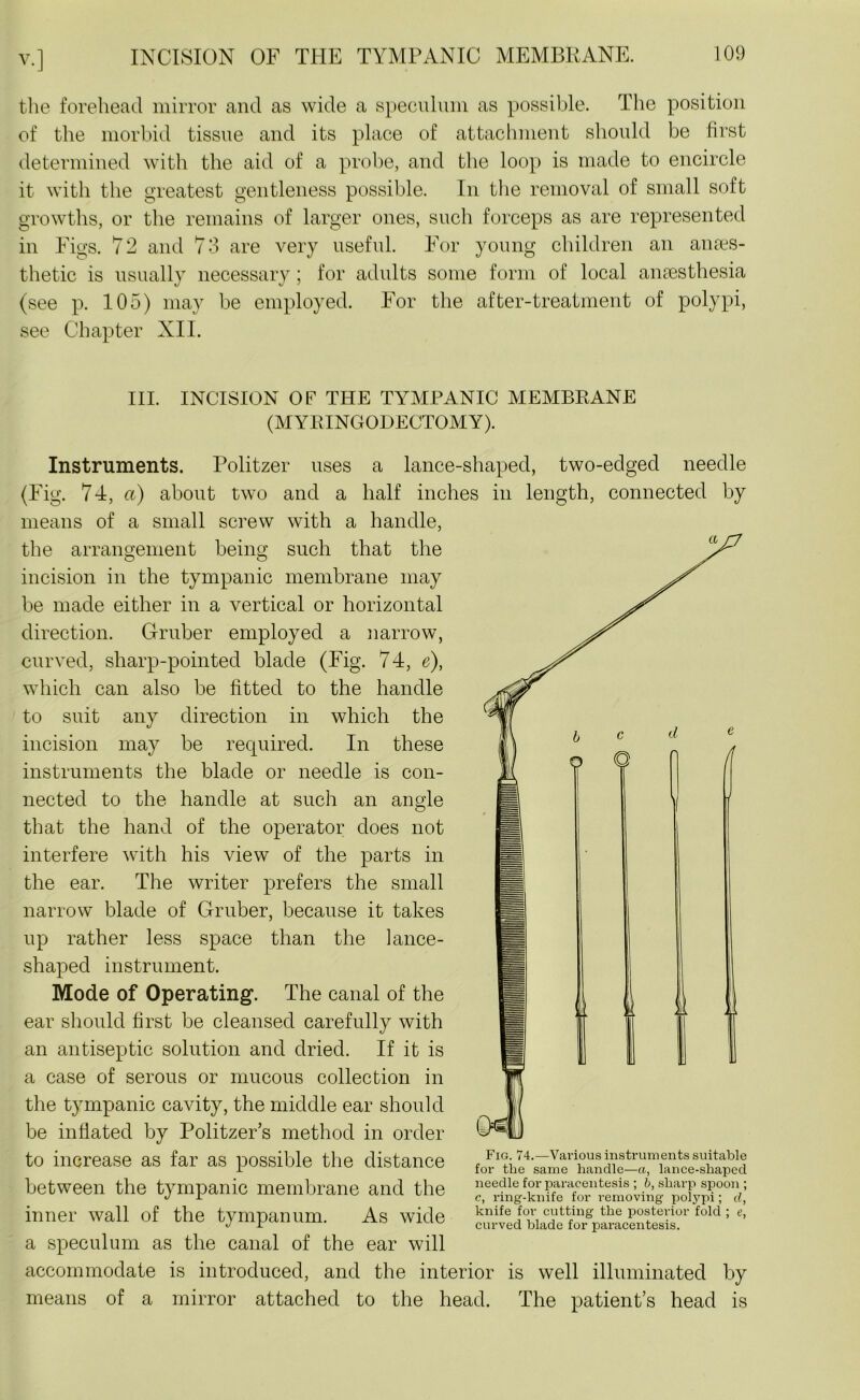 the forehead mirror and as wide a speculum as possible. The position of the morbid tissue and its place of attachment should be first determined with the aid of a probe, and the loop is made to encircle it with the greatest gentleness possible. In the removal of small soft growths, or the remains of larger ones, such forceps as are represented in Figs. 72 and 73 are very useful. For young children an anaes- thetic is usually necessary; for adults some form of local anaesthesia (see p. 105) may be employed. For the after-treatment of polypi, see Chapter XII. III. INCISION OF THE TYMPANIC MEMBRANE (MYRINGODECTOMY). Instruments. Politzer uses a lance-shaped, two-edged needle (Fig. 74, a) about two and a half inches in length, connected by means of a small screw with a handle, the arrangement being such that the incision in the tympanic membrane may be made either in a vertical or horizontal direction. Gruber employed a narrow, curved, sharp-pointed blade (Fig. 74, e), which can also be fitted to the handle to suit any direction in which the incision may be required. In these instruments the blade or needle is con- nected to the handle at such an angle that the hand of the operator does not interfere with his view of the parts in the ear. The writer prefers the small narrow blade of Gruber, because it takes up rather less space than the lance- shaped instrument. Mode of Operating. The canal of the ear should first be cleansed carefully with an antiseptic solution and dried. If it is a case of serous or mucous collection in the tympanic cavity, the middle ear should be inflated by Politzer’s method in order to increase as far as possible the distance between the tympanic membrane and the inner wall of the tympanum. As wide a speculum as the canal of the ear will accommodate is introduced, and the interior is well illuminated by means of a mirror attached to the head. The patient’s head is Fig. 74.—Various instruments suitable for tlie same handle—a, lance-shaped needle for paracentesis ; b, sharp spoon ; c, ring-knife for removing polypi; d, knife for cutting the posterior fold ; e, curved blade for paracentesis.