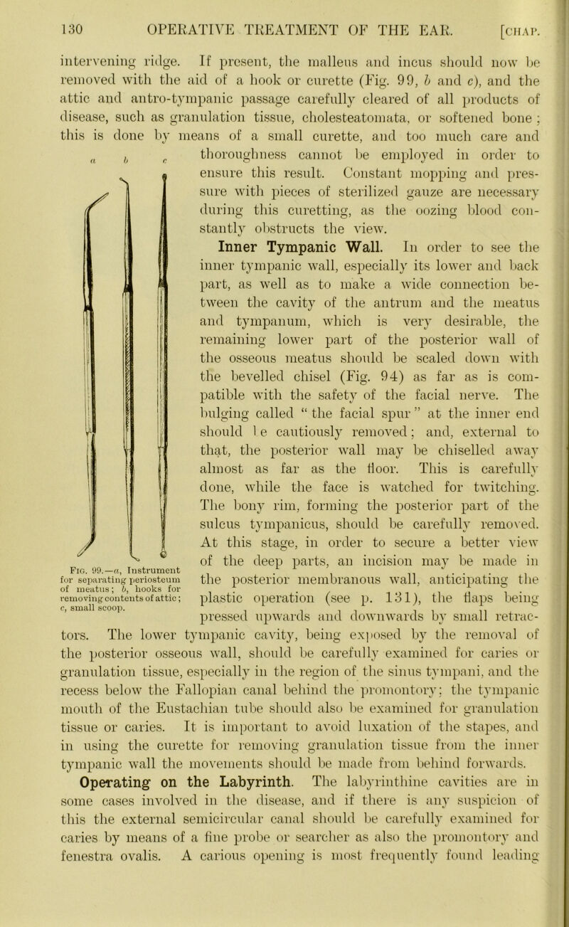 intervening ridge. If present, the malleus and incus should now be removed with the aid of a hook or curette (Fig. 99, b and c), and the attic and antro-tympanic passage carefully cleared of all products of disease, such as granulation tissue, cholesteatomata, or softened bone ; this is done by means of a small curette, and too much care and thoroughness cannot be employed in order to ensure this result. Constant mopping and pres- sure with pieces of sterilized gauze are necessary during this curetting, as the oozing blood con- stantly obstructs the view. Inner Tympanic Wall. In order to see the inner tympanic wall, especially its lower and back part, as well as to make a wide connection be- tween the cavity of the antrum and the meatus and tympanum, which is very desirable, the remaining lower part of the posterior wall of the osseous meatus should be scaled down with the bevelled chisel (Fig. 94) as far as is com- patible with the safety of the facial nerve. The bulging called “ the facial spur at the inner end should 1 e cautiously removed; and, external to that, the posterior wall may be chiselled away almost as far as the door. This is carefullv «/ done, while the face is watched for twitching. The bony rim, forming the posterior part of the sulcus tympanicus, should be carefully removed. At this stage, in order to secure a better view of the deep parts, an incision may be made in Fig. 99.—a, Instrument . ... for separating periosteum the posterior membranous wall, anticipating the of meatus; b, hooks for . . . removing contents of attic; plastic operation (see p. 131), the naps being c, small scoop. pressed upwards and downwards by small retrac- tors. The lower tympanic cavity, being exposed by the removal of the posterior osseous wall, should be carefully examined for caries or granulation tissue, especially in the region of the sinus tympani, and the recess below the Fallopian canal behind the promontory; the tympanic mouth of the Eustachian tube should also be examined for granulation tissue or caries. It is important to avoid luxation of the stapes, and in using the curette for removing granulation tissue from the inner tympanic wall the movements should be made from behind forwards. Operating on the Labyrinth. The labyrinthine cavities are in some cases involved in the disease, and if there is any suspicion of this the external semicircular canal should be carefully examined for caries by means of a fine probe or searcher as also the promontory and fenestra ovalis. A carious opening is most frequently found leading