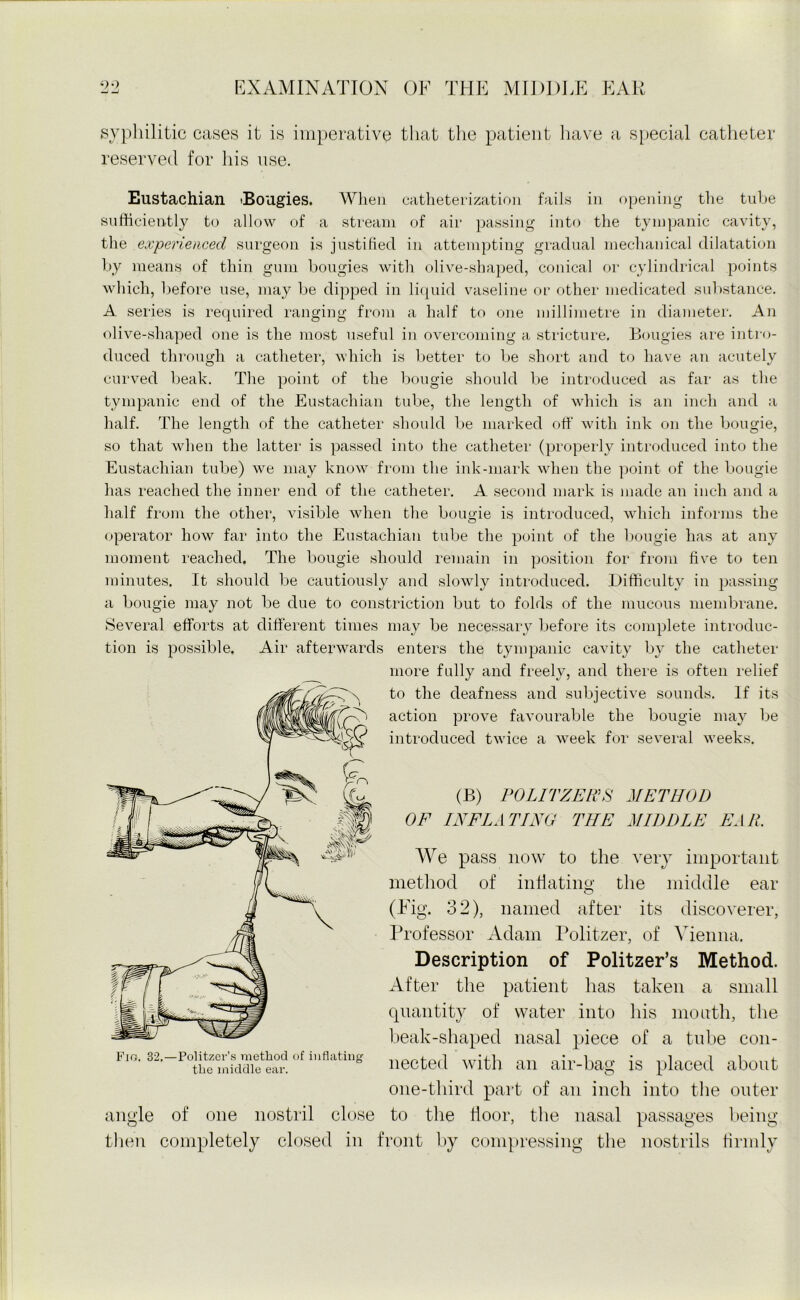 — _ syphilitic cases it is imperative that the patient have a special catheter reserved for his use. Eustachian Bougies. When catheterization fails in opening the tube sufficiently to allow of a stream of air passing into the tympanic cavity, the experienced surgeon is justified in attempting gradual mechanical dilatation by means of thin gum bougies with olive-shaped, conical or cylindrical points which, before nse, may be dipped in liquid vaseline or other medicated substance. A series is required ranging from a half to one millimetre in diameter. An olive-shaped one is the most useful in overcoming a stricture. Bougies are intro- duced through a catheter, which is better to be short and to have an acutely curved beak. The point of the bougie should be introduced as far as the tympanic end of the Eustachian tube, the length of which is an inch and a half. The length of the catheter should be marked off with ink on the bougie, so that when the latter is passed into the catheter (properly introduced into the Eustachian tube) we may know from the ink-mark when the point of the bougie has reached the inner end of the catheter. A second mark is made an inch and a half from the other, visible when the bougie is introduced, which informs the operator how far into the Eustachian tube the point of the bougie has at any moment reached. The bougie should remain in position for from five to ten minutes. It should be cautiously and slowly introduced. Difficulty in passing a bougie may not be due to constriction but to folds of the mucous membrane. Several efforts at different times may be necessary before its complete introduc- tion is possible. Air afterwards enters the tympanic cavity by the catheter more fully and freely, and there is often relief to the deafness and subjective sounds. If its action prove favourable the bougie may be introduced twice a week for several w'eeks. (B) POL I TZER'S METHOD OF INFLATING TIIE MIDDLE EAR. We pass now to the very important method of inflating the middle ear (Fig. 32), named after its discoverer, Professor Adam Politzer, of Vienna. Description of Politzer’s Method. After the patient has taken a small quantity of water into his mouth, the beak-shaped nasal piece of a tube con- nected with an air-bag is placed about one-third part of an inch into the outer to the floor, the nasal passages being Fig. 32.—Politzer’s method of inflating the middle ear. angle of one nostril close then completely closed in front by compressing the nostrils firmly