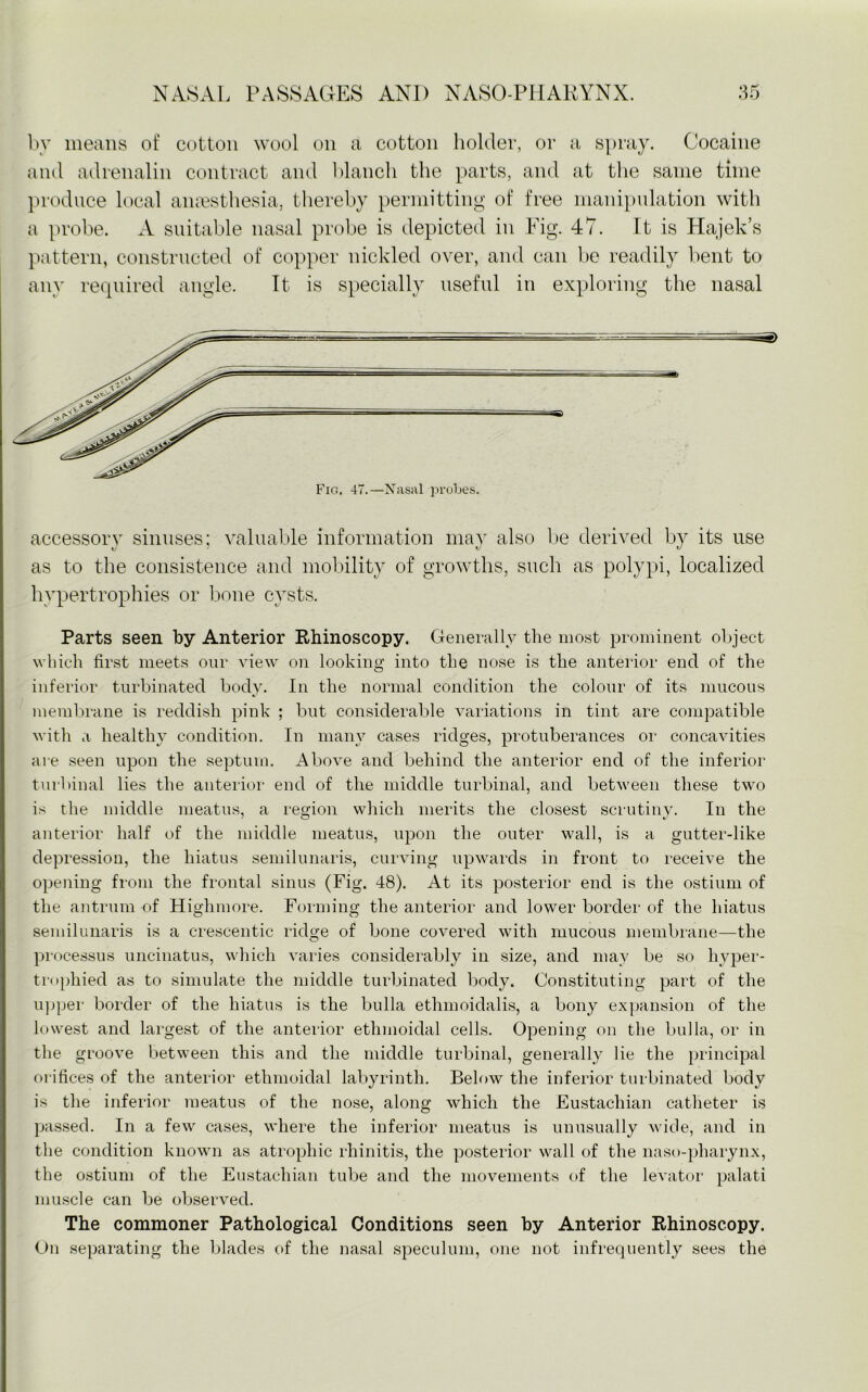 by means of cotton wool on a cotton holder, or a spray. Cocaine and adrenalin contract and blanch the parts, and at the same time produce local anaesthesia, thereby permitting of free manipulation with a probe. A suitable nasal probe is depicted in Fig. 47. It is Hajek’s pattern, constructed of copper nickled over, and can be readily bent to any required angle. It is specially useful in exploring the nasal accessory sinuses; valuable information may also be derived by its use as to the consistence and mobility of growths, such as polypi, localized hypertrophies or bone cysts. Parts seen by Anterior Rhinoscopy. Generally the most prominent object which first meets our view on looking into the nose is the anterior end of the inferior turbinated body. In the normal condition the colour of its mucous membrane is reddish pink ; but considerable variations in tint are compatible with a healthy condition. In many cases ridges, protuberances or concavities are seen upon the septum. Above and behind the anterior end of the inferior turbinal lies the anterior end of the middle turbinal, and between these two is the middle meatus, a region which merits the closest scrutiny. In the anterior half of the middle meatus, upon the outer wall, is a gutter-like depression, the hiatus semilunaris, curving upwards in front to receive the opening from the frontal sinus (Fig. 48). At its posterior end is the ostium of the antrum of Highmore. Forming the anterior and lower border of the hiatus semilunaris is a crescentic ridge of bone covered with mucous membrane—the processus uncinatus, which varies considerably in size, and may be so hyper- trophied as to simulate the middle turbinated body. Constituting part of the upper border of the hiatus is the bulla ethmoidalis, a bony expansion of the lowest and largest of the anterior ethmoidal cells. Opening on the bulla, or in the groove between this and the middle turbinal, generally lie the principal orifices of the anterior ethmoidal labyrinth. Below the inferior turbinated body is the inferior meatus of the nose, along which the Eustachian catheter is passed. In a few cases, where the inferior meatus is unusually wide, and in the condition known as atrophic rhinitis, the posterior wall of the naso-pharynx, the ostium of the Eustachian tube and the movements of the levator palati muscle can be observed. The commoner Pathological Conditions seen by Anterior Rhinoscopy. On separating the blades of the nasal speculum, one not infrequently sees the