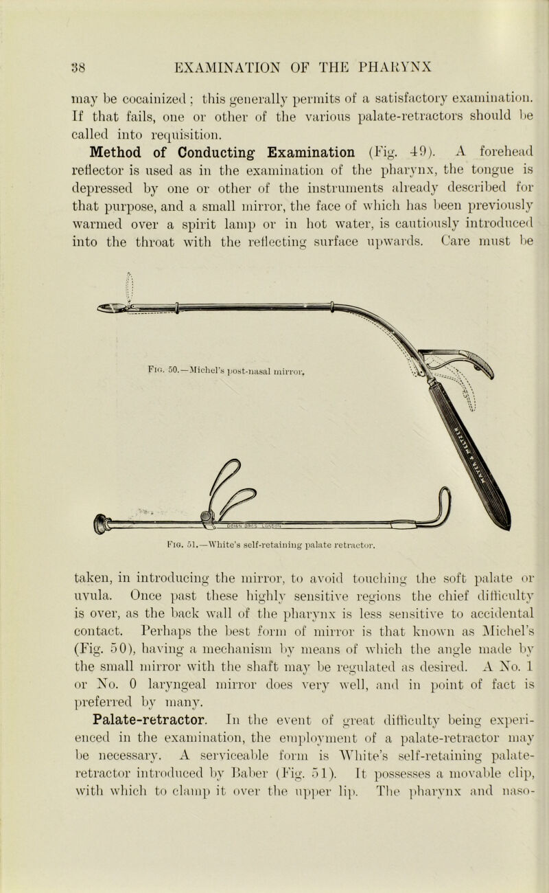 may be cocainized ; this generally permits of a satisfactory examination. If that fails, one or other of the various palate-retractors should be called into requisition. Method of Conducting Examination (Fig. 49). A forehead reflector is used as in the examination of the pharynx, the tongue is depressed by one or other of the instruments already described for that purpose, and a small mirror, the face of which has been previously warmed over a spirit lamp or in hot water, is cautiously introduced into the throat with the reflecting surface upwards. Care must be Fig. 51.—White’s self-retaining palate retractor. taken, in introducing the mirror, to avoid touching the soft palate or uvula. Once past these highly sensitive regions the chief difficulty is over, as the back wall of the pharynx is less sensitive to accidental contact. Perhaps the best form of mirror is that known as Michel’s (Fig. 50), having a mechanism by means of which the angle made bv the small mirror with the shaft may be regulated as desired. A No. 1 or No. 0 laryngeal mirror does very well, and in point of fact is preferred by many. Palate-retractor. In the event of great difficulty being experi- enced in the examination, the employment of a palate-retractor may be necessary. A serviceable form is White’s self-retaining palate- retractor introduced by Baber (Fig. 51). It possesses a movable clip, with which to clamp it over the upper lip. The pharynx and naso-