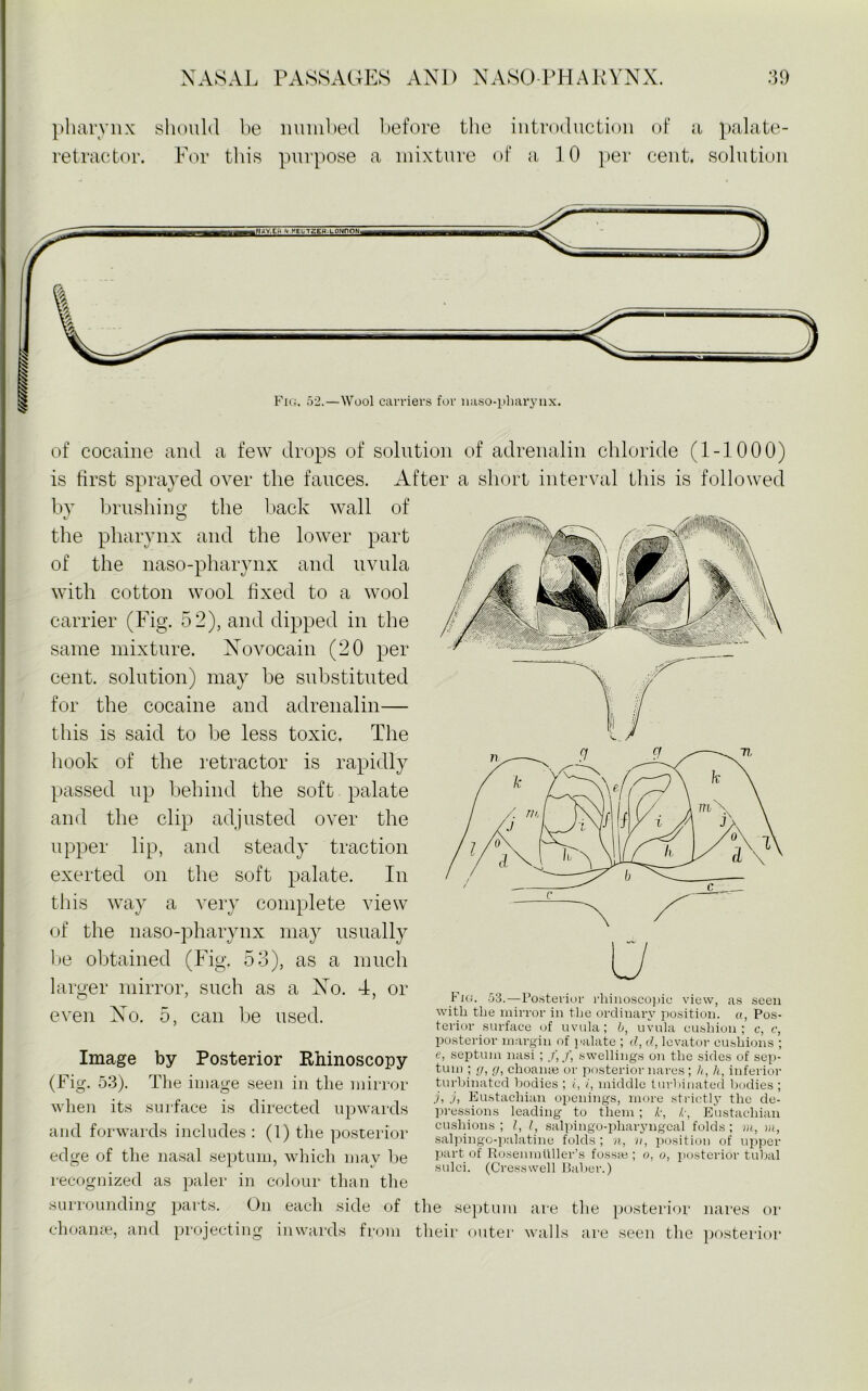 pharynx should be nlimbed before the introduction of a palate- retractor. For this purpose a mixture of a 10 per cent, solution of cocaine and a few drops of solution of adrenalin chloride (1-1000) is first sprayed over the fauces. After a short interval this is followed by brushing the back wall of the pharynx and the lower part of the naso-pharynx and uvula with cotton wool fixed to a wool carrier (Fig. 52), and dipped in the same mixture. Novocain (20 per cent, solution) may be substituted for the cocaine and adrenalin— this is said to be less toxic. The hook of the retractor is rapidly passed up behind the soft palate and the clip adjusted over the upper lip, and steady traction exerted on the soft palate. In this way a very complete view of the naso-pharynx may usually be obtained (Fig. 53), as a much larger mirror, such as a No. 4, or even No. 5, can be used. Image by Posterior Khinoscopy (Fig. 53). The image seen in the mirror when its surface is directed upwards and forwards includes : (1) the posterior edge of the nasal septum, which may be recognized as paler in colour than the surrounding parts. On each side of ehoanae, and projecting inwards from Fig. 53.—Posterior rhinoscopiu view, as seen with the mirror in the ordinary position, a, Pos- terior surface of uvula; b, uvula cushion; c, c, posterior margin of palate ; cl, cl, levator cushions ; e, septum nasi ; f, f, swellings on the sides of sep- tum ; g, g, choanne or posterior nares ; h, h, inferior turbinated bodies ; i, i, middle turbinated bodies ; j, j, Eustachian openings, more strictly the de- pressions leading to them ; k, /■, Eustachian cushions ; I, l, salpingo-pliaryngeal folds ; m, in, salpingo-palatine folds; n, v, position of upper part of Rosenmuller’s fossaj; o, o, posterior tubal sulci. (Cresswell Baber.) e septum are the posterior nares or ieir outer walls are seen the posterior