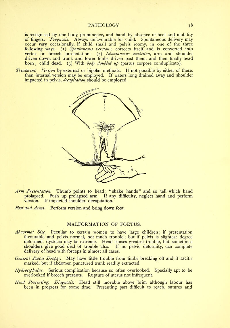 is recognised by one bony prominence, and hand by absence of heel and mobility of fingers. Prognosis. Always unfavourable for child. Spontaneous delivery may occur very occasionally, if child small and pelvis roomy, in one of the three following ways. (1) Spontaneous version; corrects itself and is converted into vertex or breech presentation. (2) Spontaneous evolution, arm and shoulder driven down, and trunk and lower limbs driven past them, and then finally head born; child dead. (3) With body doubled up (partus corpore conduplicato). Treatment. Version by external or bipolar methods. If not possible by either of these, then internal version may be employed. If waters long drained away and shoulder impacted in pelvis, decapitation should be employed. Arm Presentation. Thumb points to head; “ shake hands ” and so tell which hand prolapsed. Push up prolapsed arm. If any difficulty, neglect hand and perform version. If impacted shoulder, decapitation. Foot and Arms. Perform version and bring down foot. MALFORMATION OF FOETUS. Abnormal Size. Peculiar to certain women to have large children; if presentation favourable and pelvis normal, not much trouble; but if pelvis is slightest degree deformed, dystocia may be extreme. Head causes greatest trouble, but sometimes shoulders give good deal of trouble also. If no pelvic deformity, can complete delivery of head with forceps in almost all cases. General Foetal Dropsy. May have little trouble from limbs breaking off and if ascitis marked, but if abdomen punctured trunk readily extracted. Hydrocephalus. Serious complication because so often overlooked. Specially apt to be overlooked if breech presents. Rupture of uterus not infrequent. Head Presenting. Diagnosis. Head still movable above brim although labour has been in progress for some time. Presenting part difficult to reach, sutures and