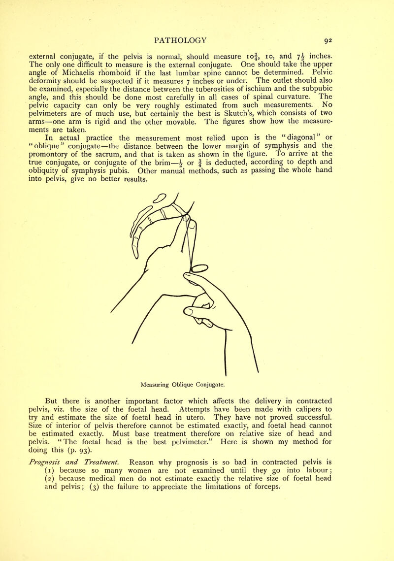 external conjugate, if the pelvis is normal, should measure iof, io, and 7J inches. The only one difficult to measure is the external conjugate. One should take the upper angle of Michaelis rhomboid if the last lumbar spine cannot be determined. Pelvic deformity should be suspected if it measures 7 inches or under. The outlet should also be examined, especially the distance between the tuberosities of ischium and the subpubic angle, and this should be done most carefully in all cases of spinal curvature. The pelvic capacity can only be very roughly estimated from such measurements. No pelvimeters are of much use, but certainly the best is Skutch’s, which consists of two arms—-one arm is rigid and the other movable. The figures show how the measure- ments are taken. In actual practice the measurement most relied upon is the “diagonal” or “ oblique ” conjugate—the distance between the lower margin of symphysis and the promontory of the sacrum, and that is taken as shown in the figure. To arrive at the true conjugate, or conjugate of the brim—\ or f is deducted, according to depth and obliquity of symphysis pubis. Other manual methods, such as passing the whole hand into pelvis, give no better results. But there is another important factor which affects the delivery in contracted pelvis, viz. the size of the foetal head. Attempts have been made with calipers to try and estimate the size of foetal head in utero. They have not proved successful. Size of interior of pelvis therefore cannot be estimated exactly, and foetal head cannot be estimated exactly. Must base treatment therefore on relative size of head and pelvis. “ The foetal head is the best pelvimeter.” Here is shown my method for doing this (p. 93). Prognosis and Treatment. Reason why prognosis is so bad in contracted pelvis is (1) because so many women are not examined until they go into labour; (2) because medical men do not estimate exactly the relative size of foetal head and pelvis; (3) the failure to appreciate the limitations of forceps.