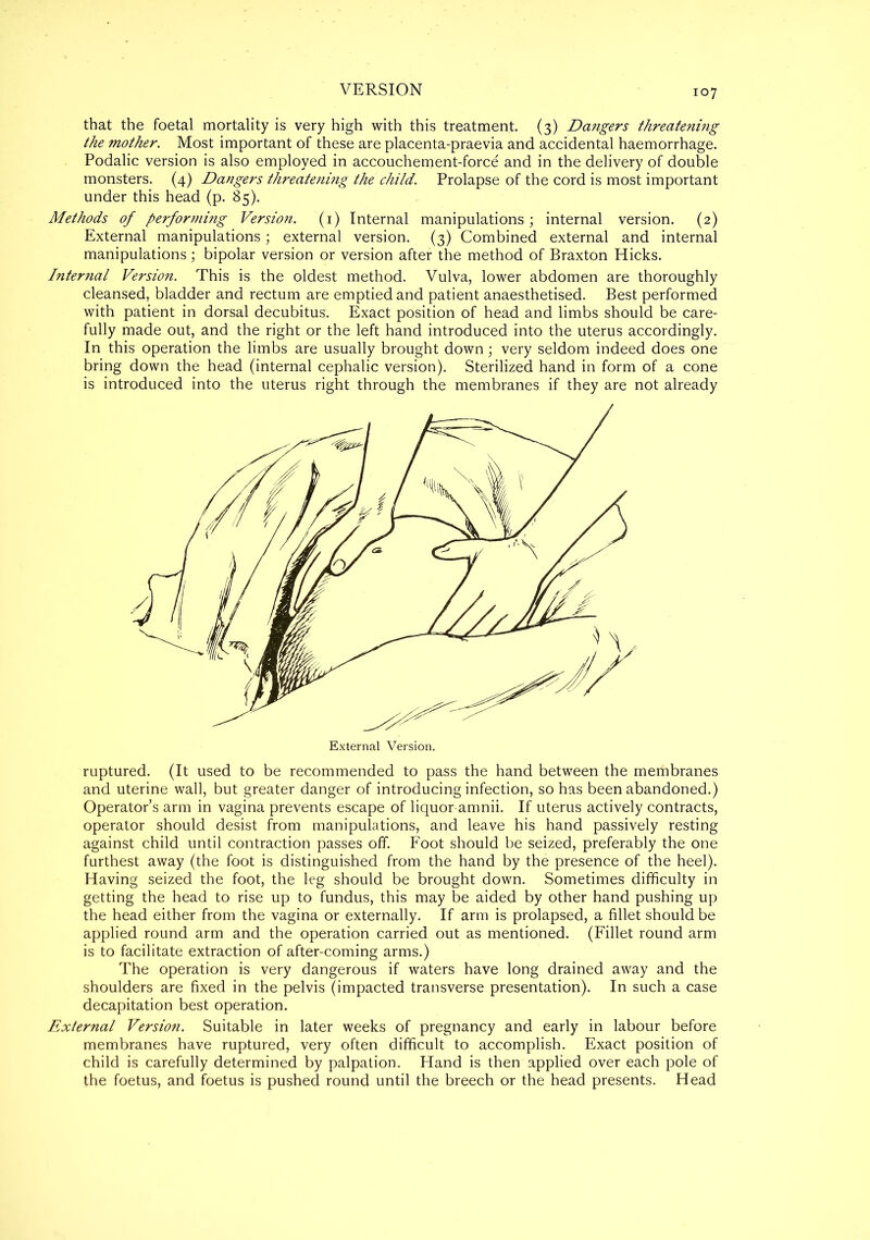 107 that the foetal mortality is very high with this treatment. (3) Dangers threatening the mother. Most important of these are placenta-praevia and accidental haemorrhage. Podalic version is also employed in accouchement-force and in the delivery of double monsters. (4) Dangers threatening the child. Prolapse of the cord is most important under this head (p. 85). Methods of performing Version. (1) Internal manipulations; internal version. (2) External manipulations; external version. (3) Combined external and internal manipulations; bipolar version or version after the method of Braxton Hicks. Internal Version. This is the oldest method. Vulva, lower abdomen are thoroughly cleansed, bladder and rectum are emptied and patient anaesthetised. Best performed with patient in dorsal decubitus. Exact position of head and limbs should be care- fully made out, and the right or the left hand introduced into the uterus accordingly. In this operation the limbs are usually brought down; very seldom indeed does one bring down the head (internal cephalic version). Sterilized hand in form of a cone is introduced into the uterus right through the membranes if they are not already ruptured. (It used to be recommended to pass the hand between the membranes and uterine wall, but greater danger of introducing infection, so has been abandoned.) Operator’s arm in vagina prevents escape of liquor-amnii. If uterus actively contracts, operator should desist from manipulations, and leave his hand passively resting against child until contraction passes off. Foot should be seized, preferably the one furthest away (the foot is distinguished from the hand by the presence of the heel). Having seized the foot, the leg should be brought down. Sometimes difficulty in getting the head to rise up to fundus, this may be aided by other hand pushing up the head either from the vagina or externally. If arm is prolapsed, a fillet should be applied round arm and the operation carried out as mentioned. (Fillet round arm is to facilitate extraction of after-coming arms.) The operation is very dangerous if waters have long drained away and the shoulders are fixed in the pelvis (impacted transverse presentation). In such a case decapitation best operation. External Versio?i. Suitable in later weeks of pregnancy and early in labour before membranes have ruptured, very often difficult to accomplish. Exact position of child is carefully determined by palpation. Hand is then applied over each pole of the foetus, and foetus is pushed round until the breech or the head presents. Head