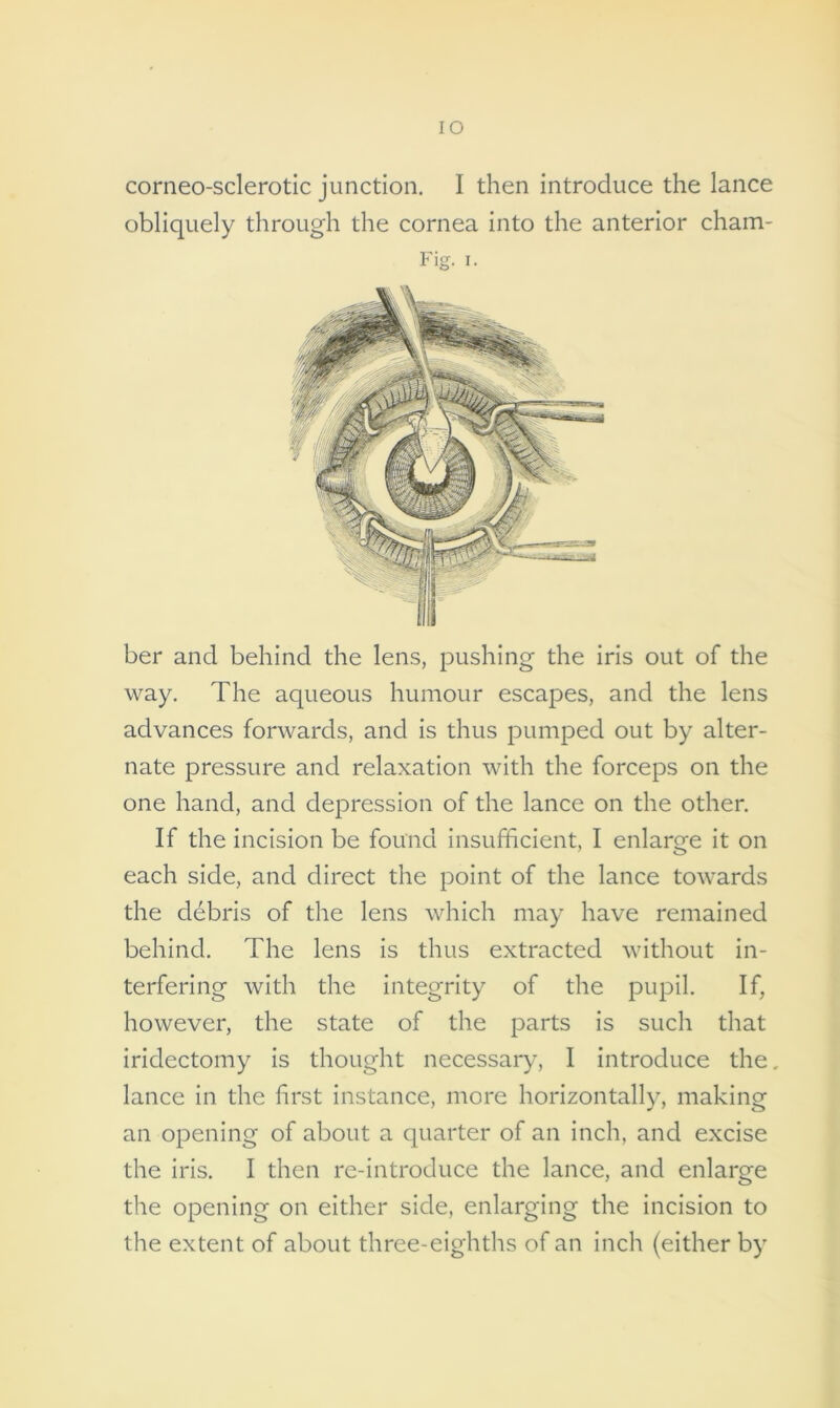 IO corneo-sclerotic junction. I then introduce the lance obliquely through the cornea into the anterior chain- Fig. i. ber and behind the lens, pushing the iris out of the way. The aqueous humour escapes, and the lens advances forwards, and is thus pumped out by alter- nate pressure and relaxation with the forceps on the one hand, and depression of the lance on the other. If the incision be found insufficient, I enlarge it on each side, and direct the point of the lance towards the debris of the lens which may have remained behind. The lens is thus extracted without in- terfering with the integrity of the pupil. If, however, the state of the parts is such that iridectomy is thought necessary, I introduce the. lance in the first instance, more horizontally, making an opening of about a quarter of an inch, and excise the iris. I then re-introduce the lance, and enlarge the opening on either side, enlarging the incision to the extent of about three-eighths of an inch (either by