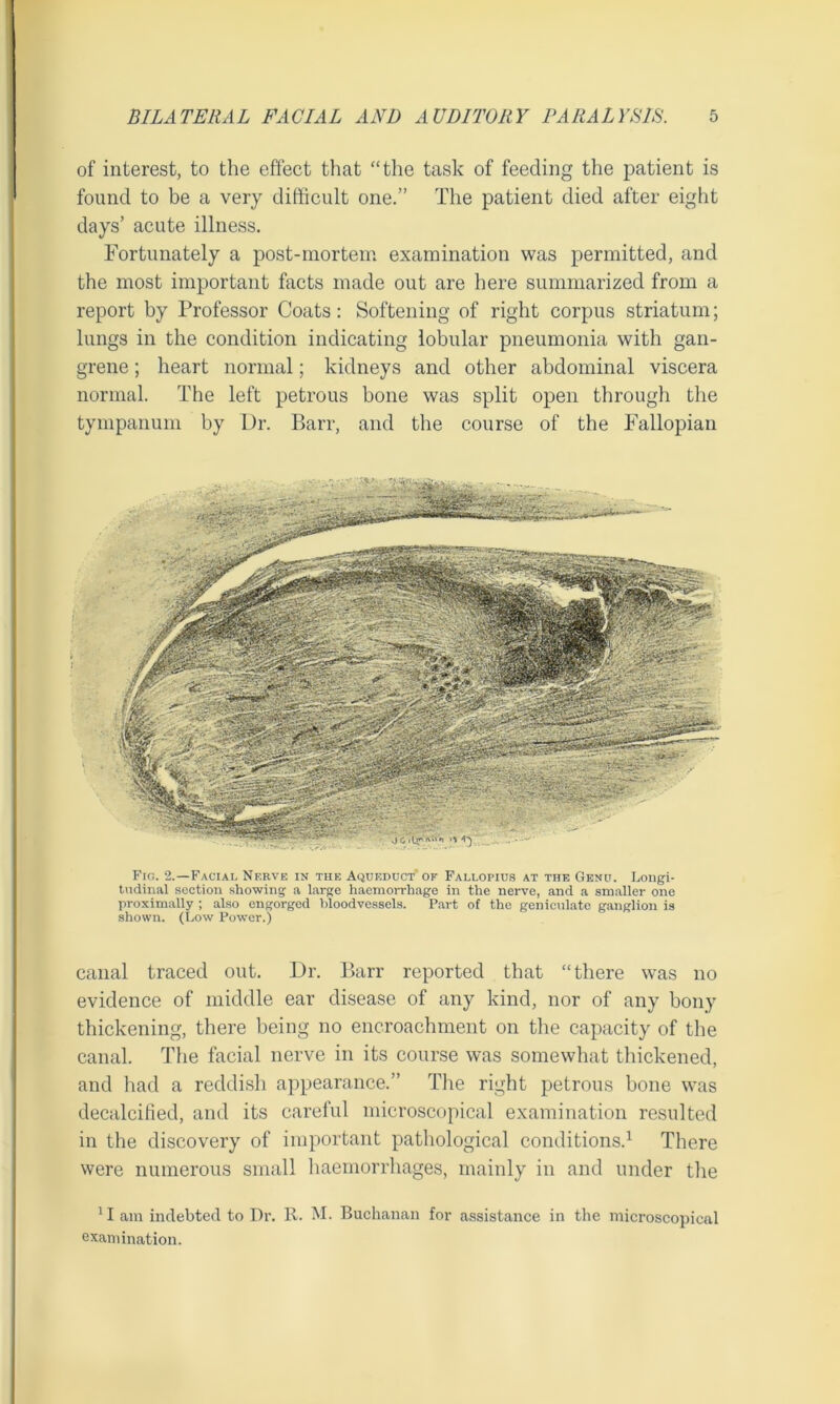 of interest, to the effect that “the task of feeding the patient is found to be a very difficult one.” The patient died after eight days’ acute illness. Fortunately a post-mortem examination was permitted, and the most important facts made out are here summarized from a report by Professor Coats: Softening of right corpus striatum; lungs in the condition indicating lobular pneumonia with gan- grene ; heart normal; kidneys and other abdominal viscera normal. The left petrous bone was split open through the tympanum by Dr. Barr, and the course of the Fallopian Fig. 2.—Facial Nerve in the Aqueduct of Fallopius at the Genu. Longi- tudinal section showing a large haemorrhage in the nerve, and a smaller one proximally ; also engorged bloodvessels. Part of the geniculate ganglion is shown. (Low Power.) canal traced out. Dr. Barr reported that “there was no evidence of middle ear disease of any kind, nor of any bony thickening, there being no encroachment on the capacity of the canal. The facial nerve in its course was somewhat thickened, and had a reddish appearance.” The right petrous bone was decalcified, and its careful microscopical examination resulted in the discovery of important pathological conditions.1 There were numerous small haemorrhages, mainly in and under the 11 am indebted to Dr. R. M. Buchanan for assistance in the microscopical examination.