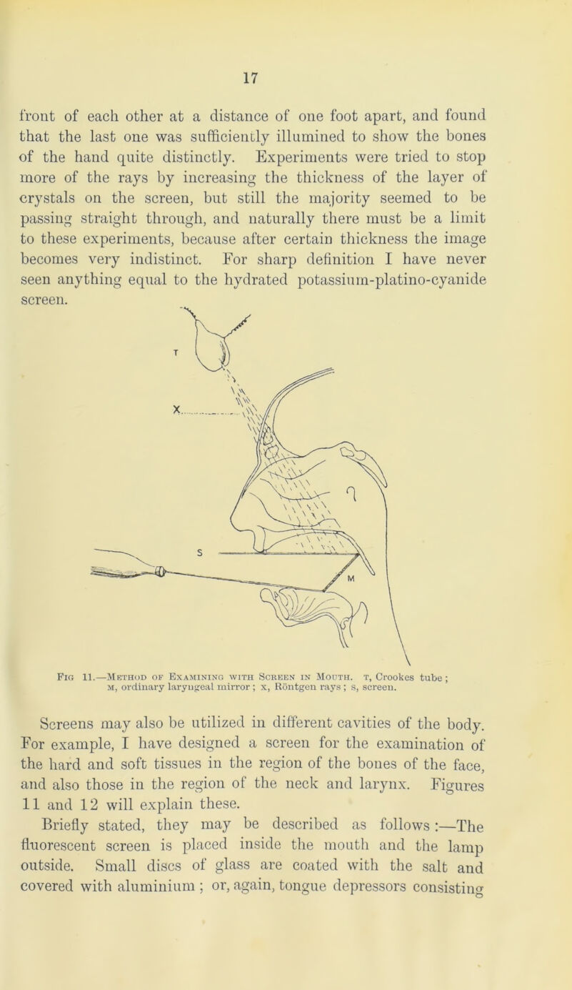front of each other at a distance of one foot apart, and found that the last one was sufficiently illumined to show the bones of the hand quite distinctly. Experiments were tried to stop more of the rays by increasing the thickness of the layer of crystals on the screen, but still the majority seemed to be passing straight through, and naturally there must be a limit to these experiments, because after certain thickness the image becomes very indistinct. For sharp definition I have never seen anything equal to the hydrated potassimn-platino-cyanide screen. Screens may also be utilized in different cavities of the body. For example, I have designed a screen for the examination of the hard and soft tissues in the region of the bones of the face, and also those in the region of the neck and larynx. Figures 11 and 12 will explain these. Briefly stated, they may be described as follows :—The fluorescent screen is placed inside the mouth and the lamp outside. Small discs of glass are coated with the salt and covered with aluminium ; or, again, tongue depressors consisting