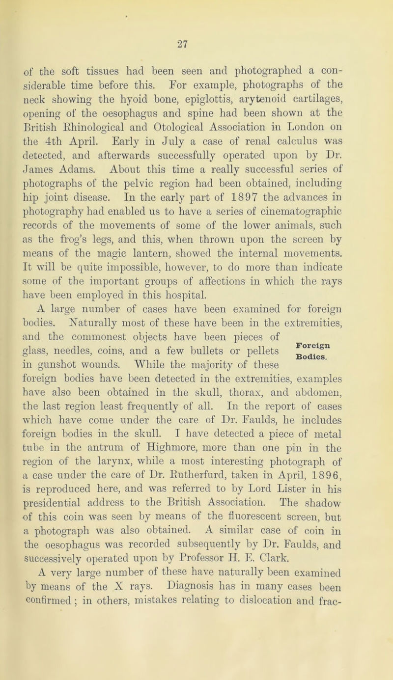 of the soft tissues had been seen and photographed a con- siderable time before this. For example, photographs of the neck showing the hyoid bone, epiglottis, arytenoid cartilages, opening of the oesophagus and spine had been shown at the British Bhinological and Otological Association in London on the 4th April. Early in July a case of renal calculus was detected, and afterwards successfully operated upon by Dr. James Adams. About this time a really successful series of photographs of the pelvic region had been obtained, including hip joint disease. In the early part of 1897 the advances in photography had enabled us to have a series of cinematographic records of the movements of some of the lower animals, such as the frog’s legs, and this, when thrown upon the screen by means of the magic lantern, showed the internal movements. It will be quite impossible, however, to do more than indicate some of the important groups of affections in which the rays have been employed in this hospital. A large number of cases have been examined for foreign bodies. Naturally most of these have been in the extremities, and the commonest objects have been pieces of glass, needles, coins, and a few bullets or pellets in gunshot wounds. While the majority of these foreign bodies have been detected in the extremities, examples have also been obtained in the skull, thorax, and abdomen, the last region least frequently of all. In the report of cases which have come under the care of Dr. Faulds, he includes foreign bodies in the skull. I have detected a piece of metal tube in the antrum of Highmore, more than one pin in the region of the larynx, while a most interesting photograph of a case under the care of Dr. Butherfurd, taken in April, 1896, is reproduced here, and was referred to by Lord Lister in his presidential address to the British Association. The shadow of this coin was seen by means of the fluorescent screen, but a photograph was also obtained. A similar case of coin in the oesophagus was recorded subsequently by Dr. Faulds, and successively operated upon by Professor IL. E. Clark. A very large number of these have naturally been examined by means of the X rays. Diagnosis has in many cases been confirmed ; in others, mistakes relating to dislocation and frac-