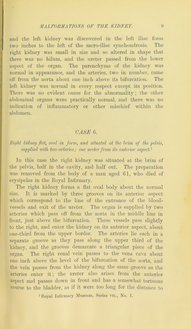 and the left kidney was discovered in the left iliac fossa two inches to the left of the sacro-iliac synchondrosis. The right kidney was small in size and so altered in shape that there was no hilum, and the ureter passed from the lower aspect of the organ. The parenchyma of the kidney was normal in appearance, and the arteries, two in number, came off from the aorta about one inch above its bifurcation. The left kidney was normal in every respect except its position. There was no evident cause for the abnormality; the other abdominal organs were practically normal, and there was no indication of inflammatory or other mischief within the abdomen. CASE 6. Right kidney flat, oval in form, and situated at the brim of the pelvis, supplied with tivo arteries; one ureter from its anterior aspectd In this case the right kidney was situated at the brim of the pelvis, half in the cavity, and half out. The preparation was removed from the body of a man aged 61, who died of erysipelas in the Boyal Infirmary. The right kidney forms a flat oval body about the normal size. It is marked by three grooves on its anterior aspect which correspond to the line of the entrance of the blood- vessels and exit of the ureter. The organ is supplied by two arteries which pass off from the aorta in the middle line in front, just above the bifurcation. These vessels pass slightly to the right, and enter the kidney on its anterior aspect, about one-tliird from the upper border. The arteries lie each in a separate groove as they pass along the upper third of the kidney, and the grooves demarcate a triangular piece of the organ. The right renal vein passes to the vena cava about one inch above the level of the bifurcation of the aorta, and the vein passes from the kidney along the same groove as the arteries enter it; the ureter also arises from the anterior aspect and passes down in front and has a somewhat tortuous course to the bladder, as if it were too long for the distance to