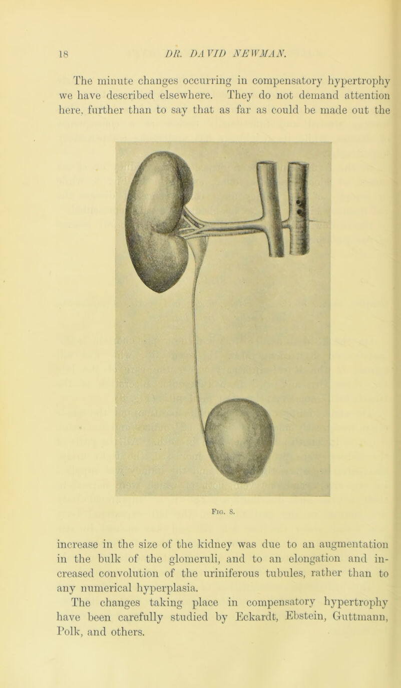 The minute changes occurring in compensatory hypertrophy vve have described elsewhere. They do not demand attention here, further than to say that as far as could be made out the Fig. 8. increase in the size of the kidney was due to an augmentation in the bulk of the glomeruli, and to an elongation and in- creased convolution of the uriniferous tubules, rather than to any numerical hyperplasia. The changes taking place in compensatory hypertrophy have been carefully studied by Eckardt, Ebstein, Guttmann, Polk, and others.