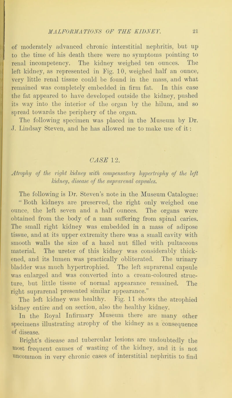 of moderately advanced chronic interstitial nephritis, but up to the time of his death there were no symptoms pointing to renal incompetency. The kidney weighed ten ounces. The left kidney, as represented in Fig. 10, weighed half an ounce, very little renal tissue could be found in the mass, and what remained was completely embedded in firm flit. In this case the fat appeared to have developed outside the kidney, pushed its way into the interior of the organ by the hilum, and so spread towards the periphery of the organ. I The following specimen was placed in the Museum by Dr. J. Lindsay Steven, and he has allowed me to make use of it: CASE 12. Atrophy of the right kidney with compensatory hypertrophy of the left kidney, disease of the suprarenal capsules. The following is Dr. Steven’s note in the Museum Catalogue: “ Both kidneys are preserved, the right only weighed one ounce, the left seven and a half ounces. The organs were obtained from the body of a man suffering from spinal caries. The small right kidney was embedded in a mass of adipose tissue, and at its upper extremity there was a small cavity with smooth walls the size of a hazel nut filled with pultaceous material. The ureter of this kidney was considerably thick- ened, and its lumen was practically obliterated. The urinary bladder was much hypertrophied. The left suprarenal capsule was enlarged and was converted into a cream-coloured struc- ture, but little tissue of normal appearance remained. The right suprarenal presented similar appearance.” The left kidney was healthy. Fig. 11 shows the atrophied kidney entire and on section, also the healthy kidney. In the Ptoyal Infirmary Museum there are many other specimens illustrating atrophy of the kidney as a consequence of disease. Bright’s disease and tubercular lesions are undoubtedly the most frequent causes of wasting of the kidney, and it is not uncommon in very chronic cases of interstitial nephritis to find