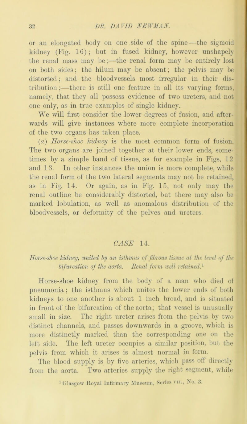 or an elongated body on one side of the spine—the sigmoid kidney (Fig. 1G); but in fused kidney, however unshapely the renal mass may be ;—the renal form may be entirely lost on both sides; the hilum may be absent; the pelvis may be distorted; and the bloodvessels most irregular in their dis- tribution ;—there is still one feature in all its varying forms, namely, that they all possess evidence of two ureters, and not one only, as in true examples of single kidney. We will first consider the lower degrees of fusion, and after- wards will give instances where more complete incorporation of the two organs has taken place. (a) Horse-slioc kidney is the most common form of fusion. The two organs are joined together at their lower ends, some- times by a simple band of tissue, as for example in Figs. 12 and 13. In other instances the union is more complete, while the renal form of the two lateral segments may not be retained, as in Fig. 14. Or again, as in Fig. 15, not only may the renal outline be considerably distorted, but there may also be marked lobulation, as well as anomalous distribution of the bloodvessels, or deformity of the pelves and ureters. CASE 14. Horse-shoe kidney, united by an isthmus of fibrous tissue at the level of the bifurcation of the aorta. Renal form well retained.1 Horse-shoe kidney from the body of a man who died oi pneumonia; the isthmus which unites the lower ends of both kidneys to one another is about 1 inch broad, and is situated in front of the bifurcation of the aorta; that vessel is unusually small in size. The right ureter arises from the pelvis by two distinct channels, and passes downwards in a groove, which is more distinctly marked than the corresponding one on the left side. The left ureter occupies a similar position, but the pelvis from which it arises is almost normal in form. The blood supply is by five arteries, which pass oil directly from the aorta. Two arteries supply the right segment, while 1 Glasgow Royal Infirmary Museum, Series vn., No. 3.