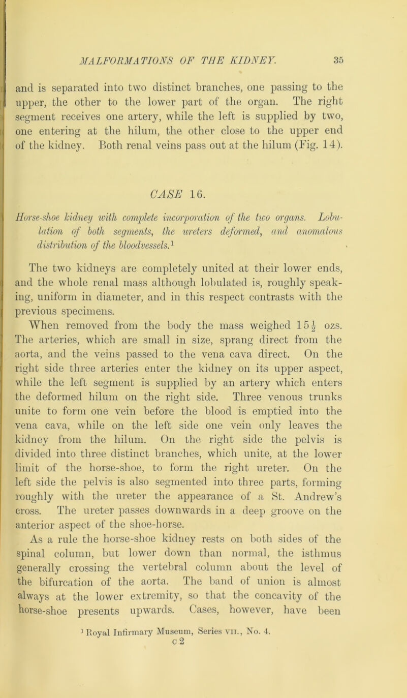 ami is separated into two distinct branches, one passing to the upper, the other to the lower part of the organ. The right segment receives one artery, while the left is supplied by two, one entering at the hilum, the other close to the upper end of the kidney. Both renal veins pass out at the hilum (Big. 14). CASE 16. Horse-Awe kidney with complete incorporation of the tico organs. Lobu- lation of both segments, the ureters deformed, and anomalous distribution of the bloodvessels.1 The two kidneys are completely united at their lower ends, and the whole renal mass although lobulated is, roughly speak- ing, uniform in diameter, and in this respect contrasts with the previous specimens. When removed from the body the mass weighed 15| ozs. The arteries, which are small in size, sprang direct from the aorta, and the veins passed to the vena cava direct. On the right side three arteries enter the kidney on its upper aspect, while the left segment is supplied by an artery which enters the deformed hilum on the right side. Three venous trunks unite to form one vein before the blood is emptied into the vena cava, while on the left side one vein only leaves the kidney from the hilum. On the right side the pelvis is divided into three distinct branches, which unite, at the lower limit of the horse-shoe, to form the right ureter. On the left side the pelvis is also segmented into three parts, forming roughly with the ureter the appearance of a St, Andrew’s cross. The ureter passes downwards in a deep groove on the anterior aspect of the shoe-horse. As a rule the horse-shoe kidney rests on both sides of the spinal column, but lower down than normal, the isthmus generally crossing the vertebral column about the level of the bifurcation of the aorta. The band of union is almost always at the lower extremity, so that the concavity of the horse-shoe presents upwards. Cases, however, have been 1 Royal Infirmary Museum, Series vii., No. 4. C 2
