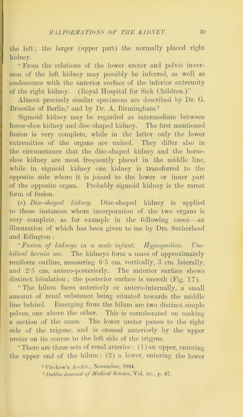 the left; the larger (upper part) the normally placed right kidney. “ From the relations of the lower ureter and pelvis inver- sion of the left kidney may possibly be inferred, as well as coalescence with the anterior surface of the inferior extremity of the right kidney. (Eoyal Hospital for Sick Children.)” Almost precisely similar specimens are described by Dr. G. Broesike of Berlin,1 and by Dr. A. Birmingham.'2 Sigmoid kidney may be regarded as intermediate between horse-shoe kidney and disc-shaped kidney. The first mentioned fusion is very complete, while in the latter only the lower extremities of the organs are united. They differ also in the circumstance that the disc-shaped kidney and the horse- shoe kidney are most frequently placed in the middle line, while in sigmoid kidney one kidney is transferred to the opposite side where it is joined to the lower or inner part of the opposite organ. Probably sigmoid kidney is the rarest form of fusion. (c) Disc-shaped kidney. Disc-shaped kidney is applied to those instances where incorporation of the two organs is very complete, as for example in the following cases—an illustration of which has been given to me by Drs. Sutherland and Edington : “ Fusion of kidneys in a male infant. Hypospadias. Um- bilical hernia sac. The kidneys form a mass of approximately reniform outline, measuring 6-5 cm. vertically, 3 cm. laterally, and 2‘5 cm. antero-posteriorly. The anterior surface shows distinct lobulation; the posterior surface is smooth (Fig. 17). “ The hilum faces anteriorly or antero-internally, a small amount of renal substance being situated towards the middle line behind. Emerging from the hilum are two distinct simple pelves, one above the other. This is corroborated on making a section of the mass. The lower ureter passes to the right side of the trigone, and is crossed anteriorly by the upper ureter on its course to the left side of the trigone. “There are three sets of renal arteries : (1) an upper, entering the upper end of the hilum; (2) a lower, entering the lower 1 Virchow’s Archiv., November, 1S84. 2 Dublin Journal of Medical Science, Vol. xc., p. 47.