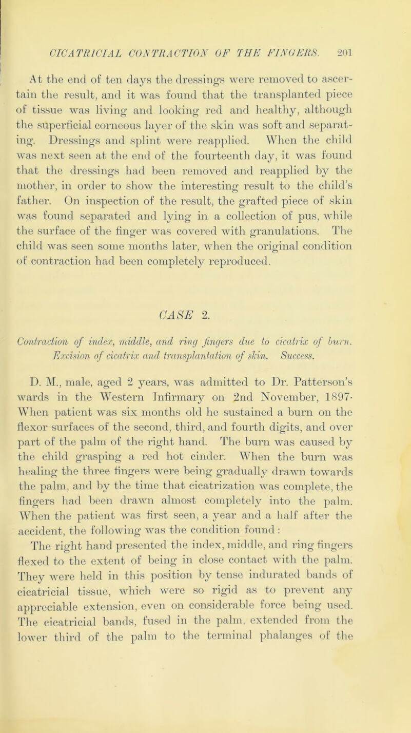 At the end of ten days the dressings were removed to ascer- tain the result, and it was found that the transplanted piece of tissue was living and looking red and healthy, although the superficial corneous layer of the skin was soft and separat- ing. Dressings and splint were reapplied. When the child was next seen at the end of the fourteenth day, it was found that the dressings had been removed and reapplied by the mother, in order to show the interesting result to the child’s father. On inspection of the result, the grafted piece of skin was found separated and lying in a collection of pus, while the surface of the finger was covered with granulations. The child was seen some months later, when the original condition of contraction had been completely reproduced. CASE 2. Contraction of index, middle, and ring fingers clue to cicatrix of burn. Excision of cicatrix and transplantation of shin. Success. D. M., male, aged 2 years, was admitted to Dr. Patterson’s wards in the Western Infirmary on 2nd November, 1897- When patient was six months old he sustained a burn on the flexor surfaces of the second, third, and fourth digits, and over part of the palm of the right hand. The burn was caused by the child grasping a red hot cinder. When the burn was healing the three fingers were being gradually drawn towards the palm, and by the time that cicatrization was complete, the fingers had been drawn almost completely into the palm. When the patient was first seen, a year and a half after the accident, the following was the condition found : The right hand presented the index, middle, and ring fingers flexed to the extent of being in close contact with the palm. They were held in this position by tense indurated bands of cicatricial tissue, which were so rigid as to prevent any appreciable extension, even on considerable force being used. The cicatricial bands, fused in the palm, extended from the lower third of the palm to the terminal phalanges of the