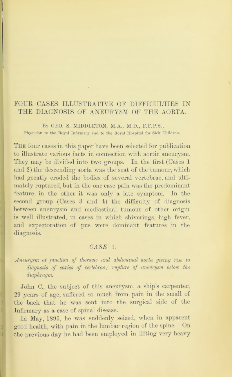 FOUR CASES ILLUSTRATIVE OF DIFFICULTIES IN THE DIAGNOSIS OF ANEURYSM OF THE AORTA. By GEO. S. MIDDLETON, M.A., M.D., F.F.P.S., Physician to the Royal Infirmary and to the Royal Hospital for Sick Children. The four cases in this paper have been selected for publication to illustrate various facts in connection with aortic aneurysm. They may be divided into two groups. In the first (Cases 1 and 2) the descending aorta was the seat of the tumour, which had greatly eroded the bodies of several vertebrae, and ulti- mately ruptured, but in the one case pain was the predominant feature, in the other it was only a late symptom. In the second group (Cases 3 and 4) the difficulty of diagnosis between aneurysm and mediastinal tumour of other origin is well illustrated, in cases in which shiverings, high fever, and expectoration of pus were dominant features in the diagnosis. CASE 1. Aneurysm at junction of thoracic and abdominal aorta (jiving rise to diagnosis of caries of vertebrae; rupture of aneurysm below the diaphragm. John C., the subject of this aneurysm, a ship's carpenter, 29 years of age, suffered so much from pain in the small of the back that he was sent into the surgical side of the Infirmary as a case of spinal disease. In May, 1895, he was suddenly seized, when in apparent good health, with pain in the lumbar region of the spine. On the previous day he had been employed in lifting very heavy