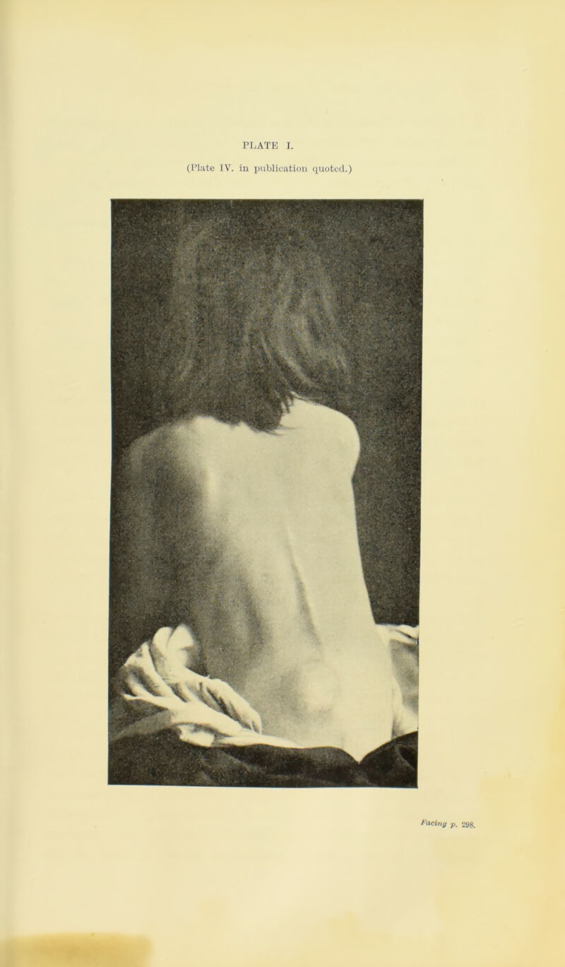 (Plate IV. in publication quoted.) Facing p. 298.